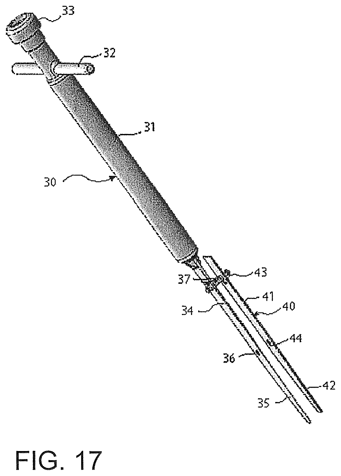 Patent US12376866 Figure 17 – Thin-blade chisel system