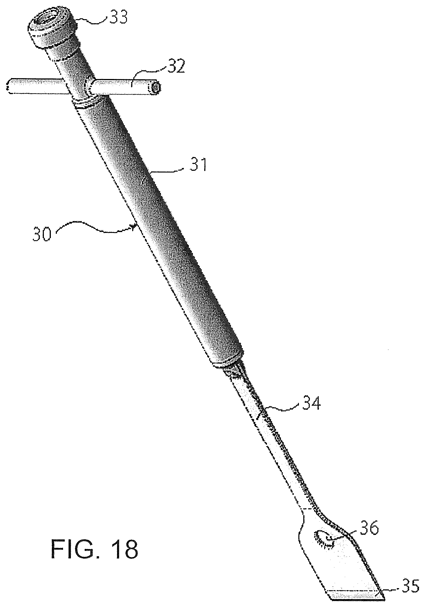 Patent US12376866 Figure 18 – Thin-blade chisel system
