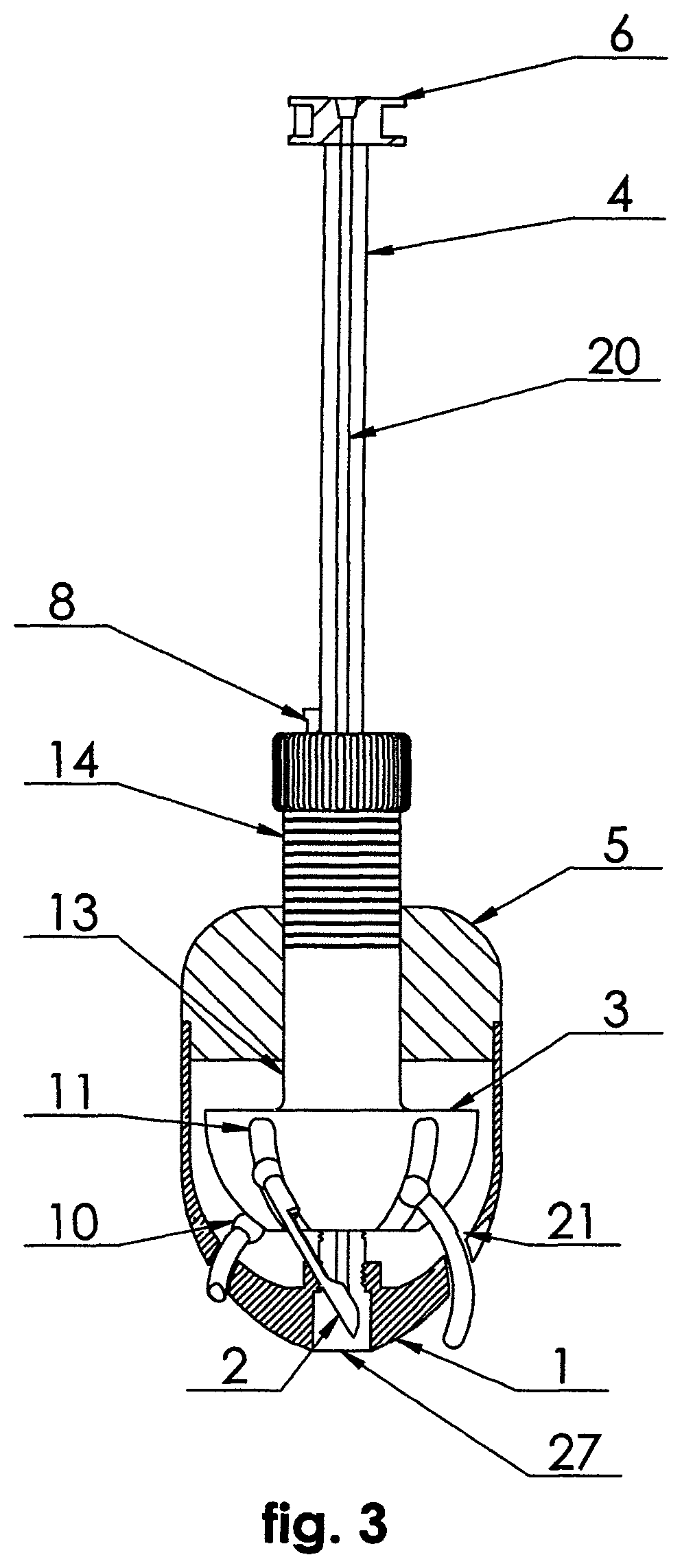 Patent US12376867 Figure 3 – Unit for the reaming of the surface of joint cartilage and of periarticular bone of an acetabulum and femoral head
