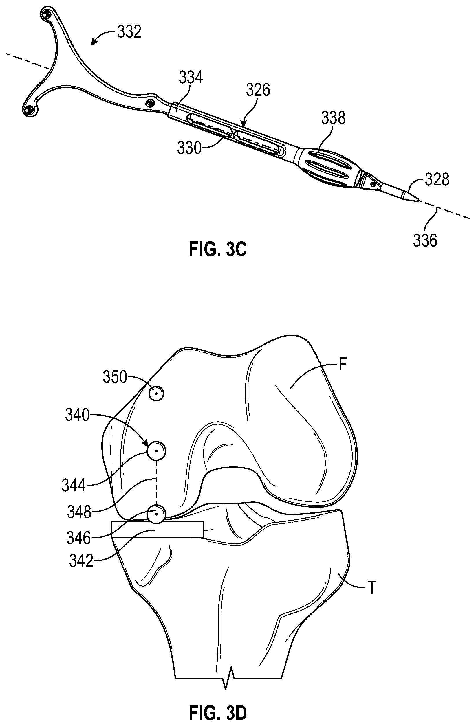 Patent US12376868 Figure 4 – Devices and methods for posterior resection in robotically assisted partial knee arthroplasties