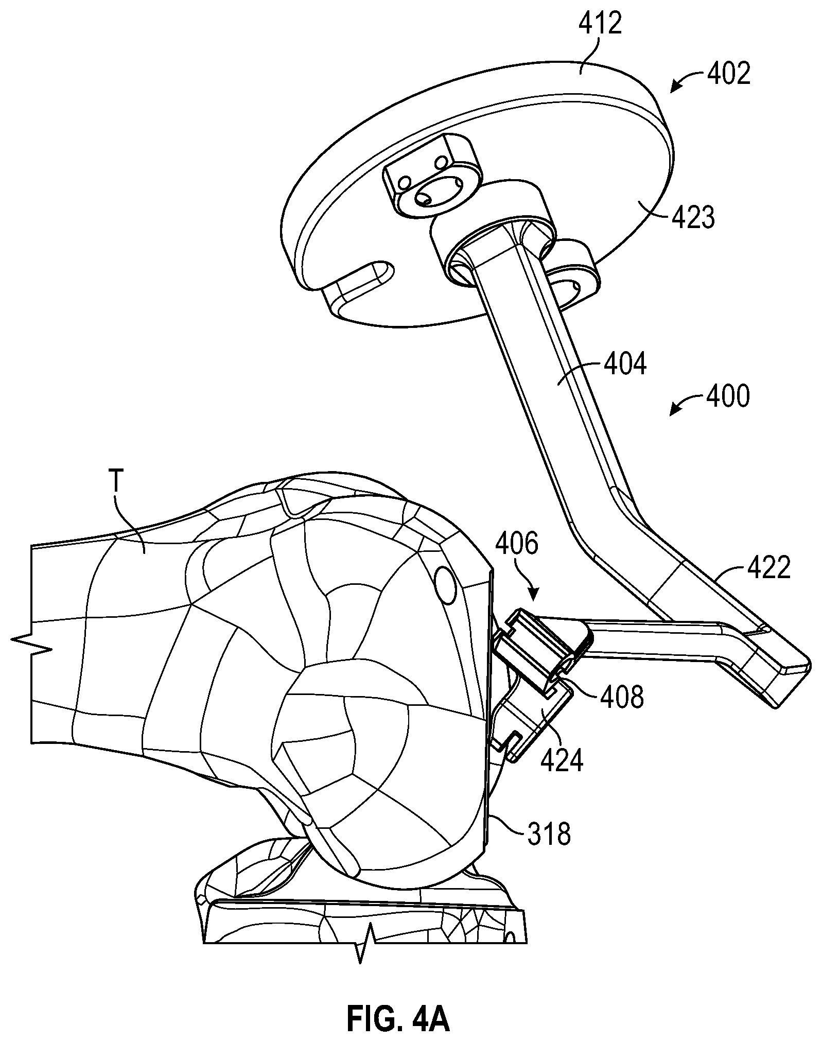 Patent US12376868 Figure 5 – Devices and methods for posterior resection in robotically assisted partial knee arthroplasties