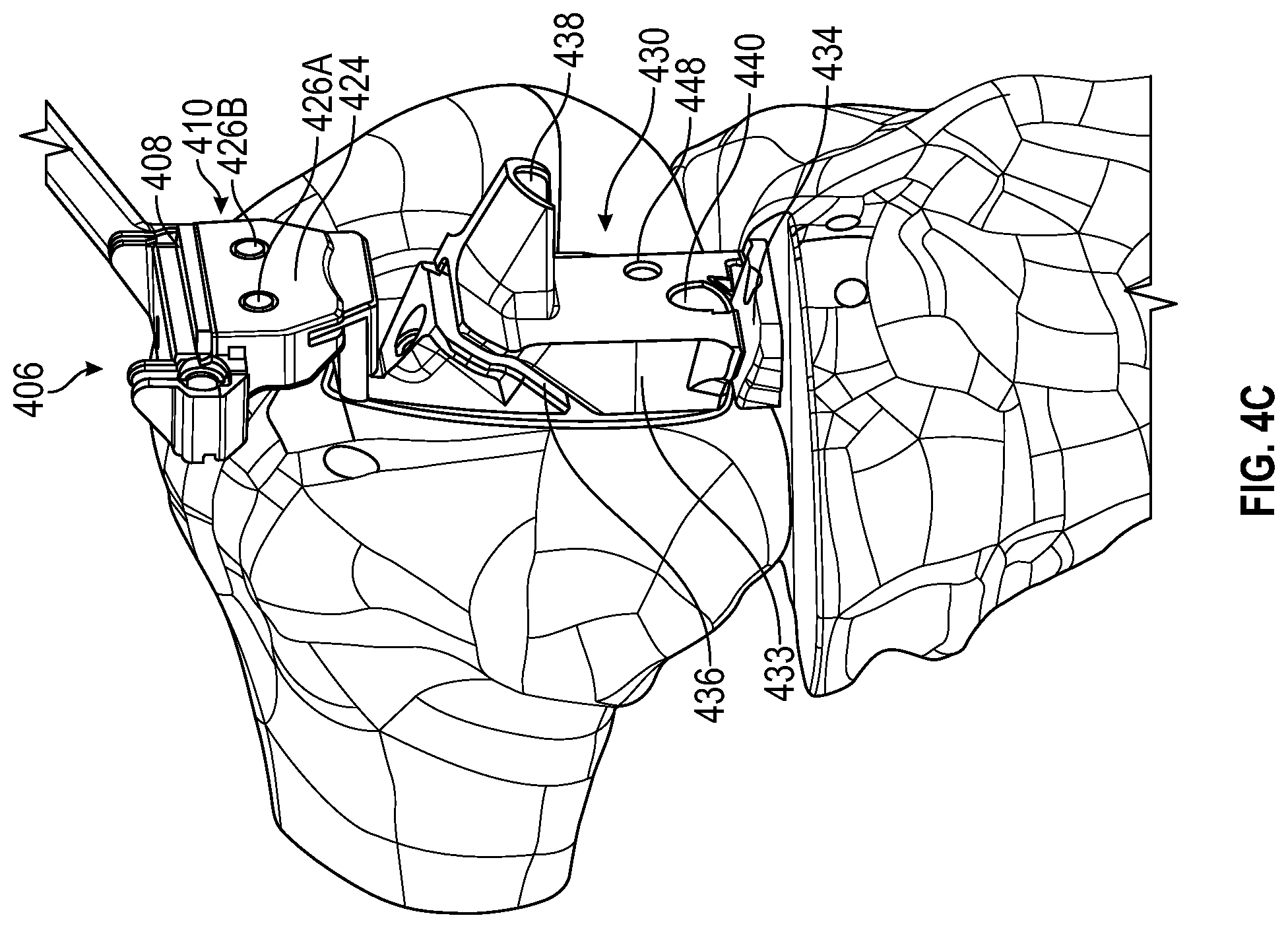 Patent US12376868 Figure 7 – Devices and methods for posterior resection in robotically assisted partial knee arthroplasties