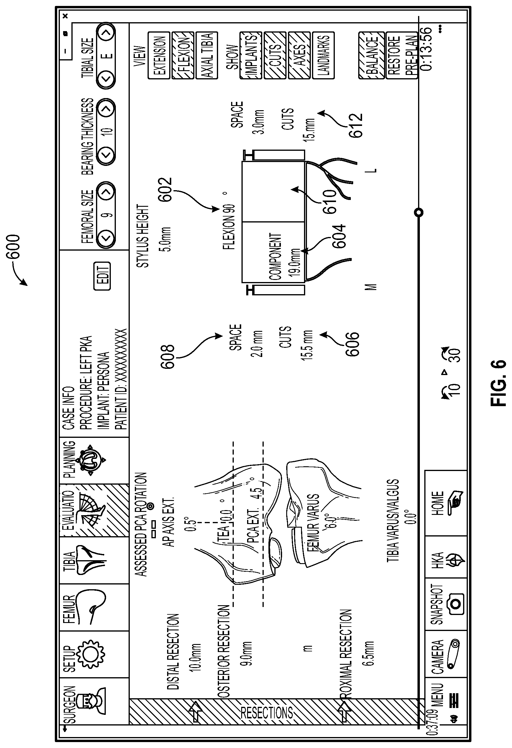 Patent US12376868 Figure 10 – Devices and methods for posterior resection in robotically assisted partial knee arthroplasties