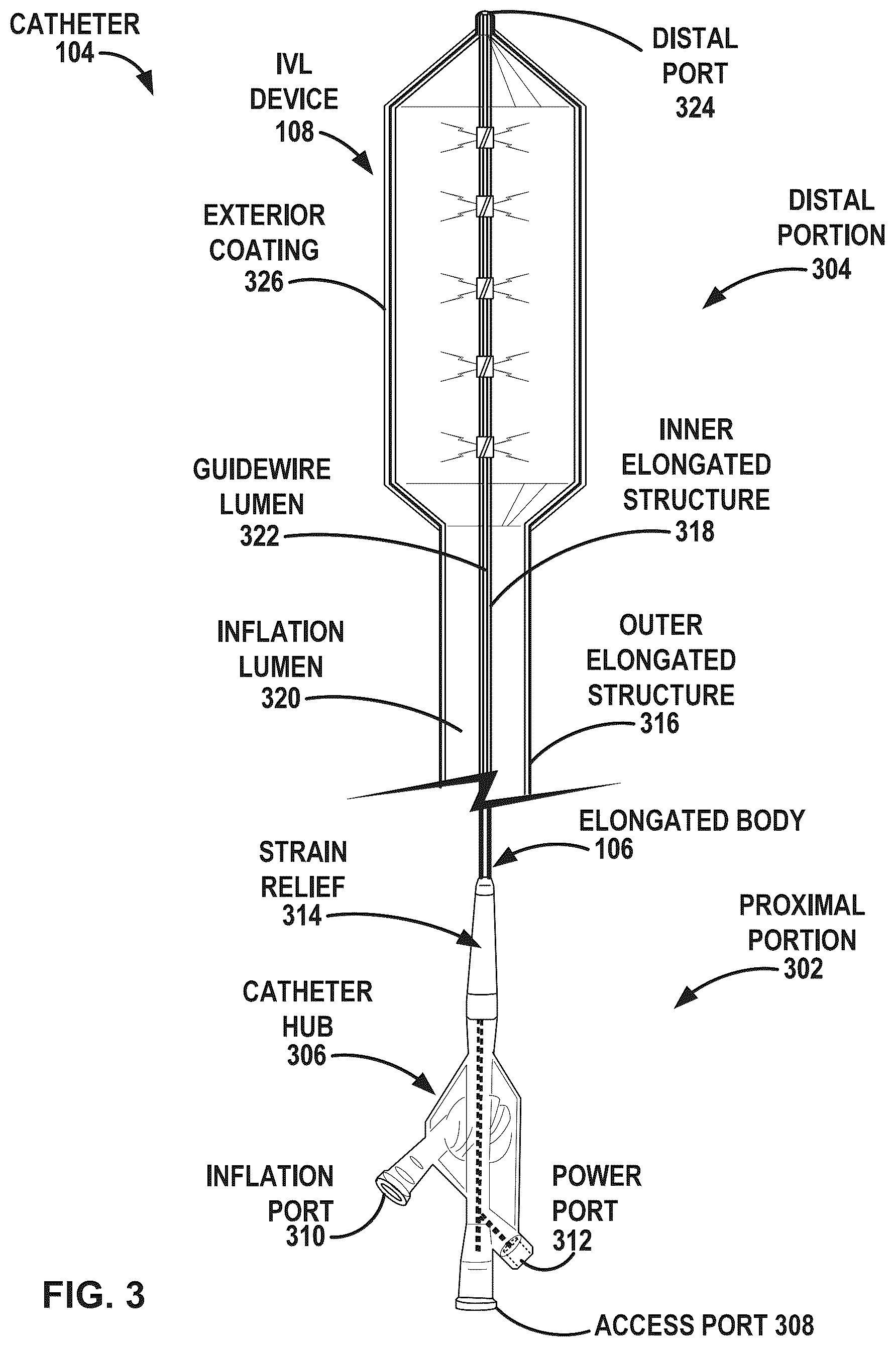 Patent US12376869 Figure 3 – Intravascular lithotripsy
