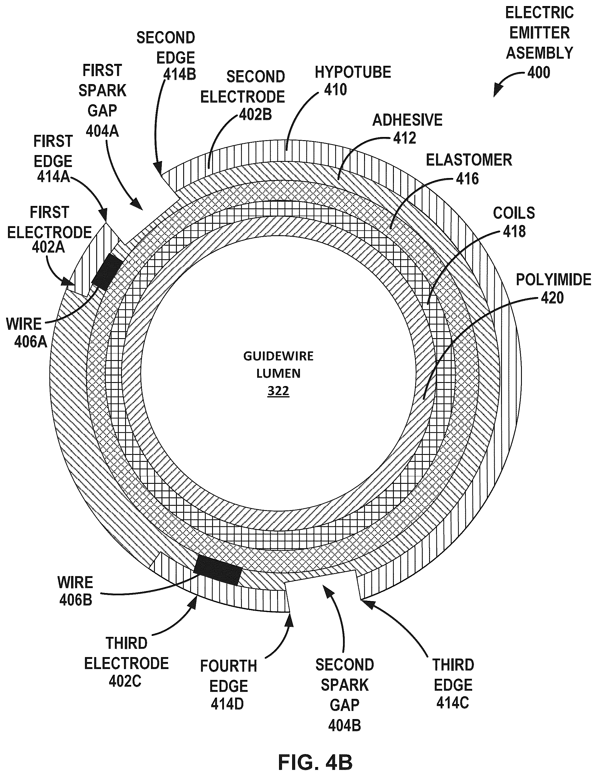 Patent US12376869 Figure 5 – Intravascular lithotripsy