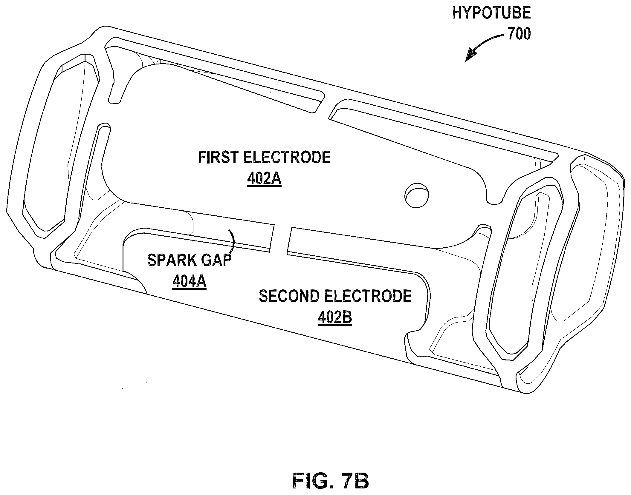 Patent US12376869 Figure 9 – Intravascular lithotripsy