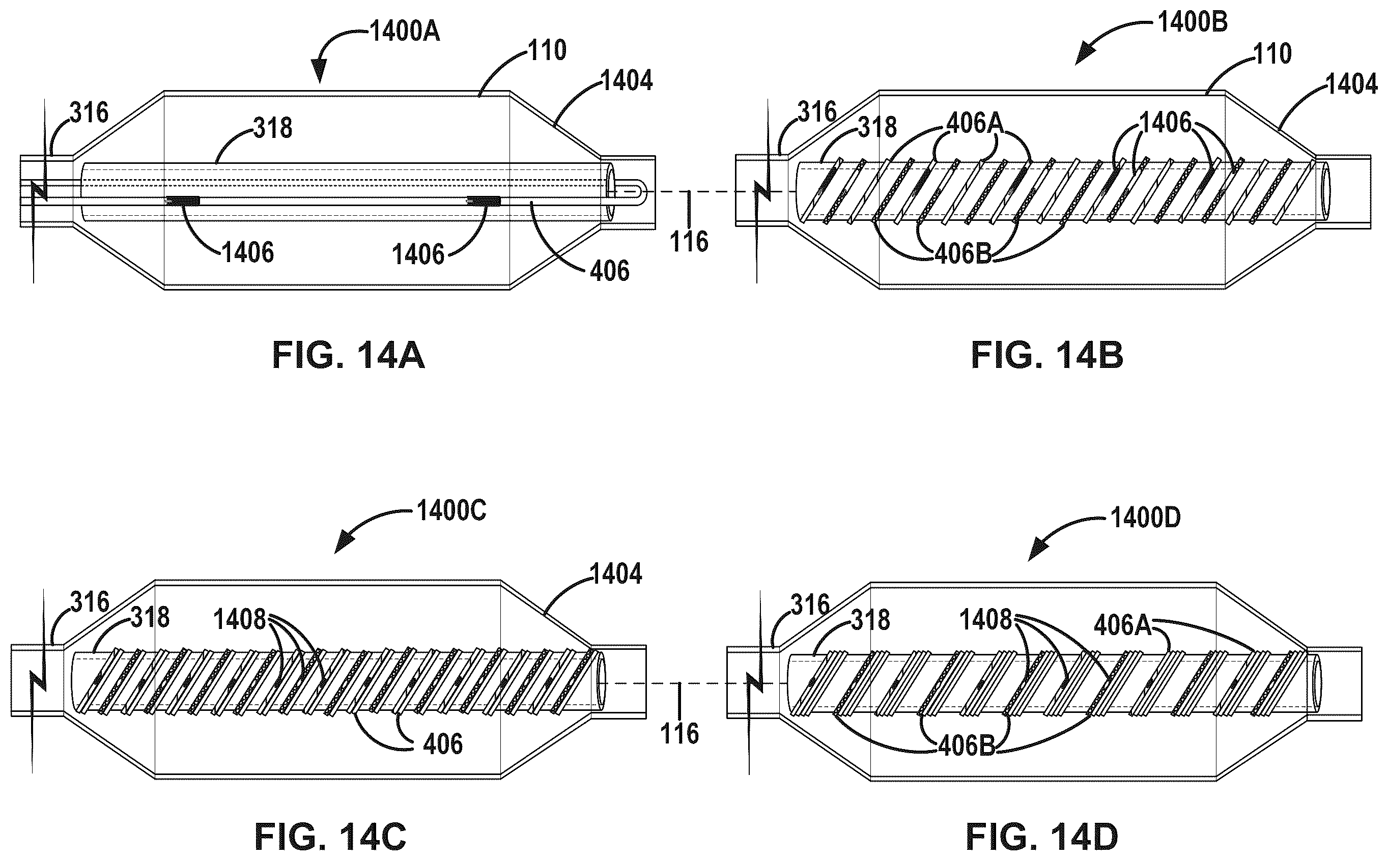 Patent US12376869 Figure 17 – Intravascular lithotripsy