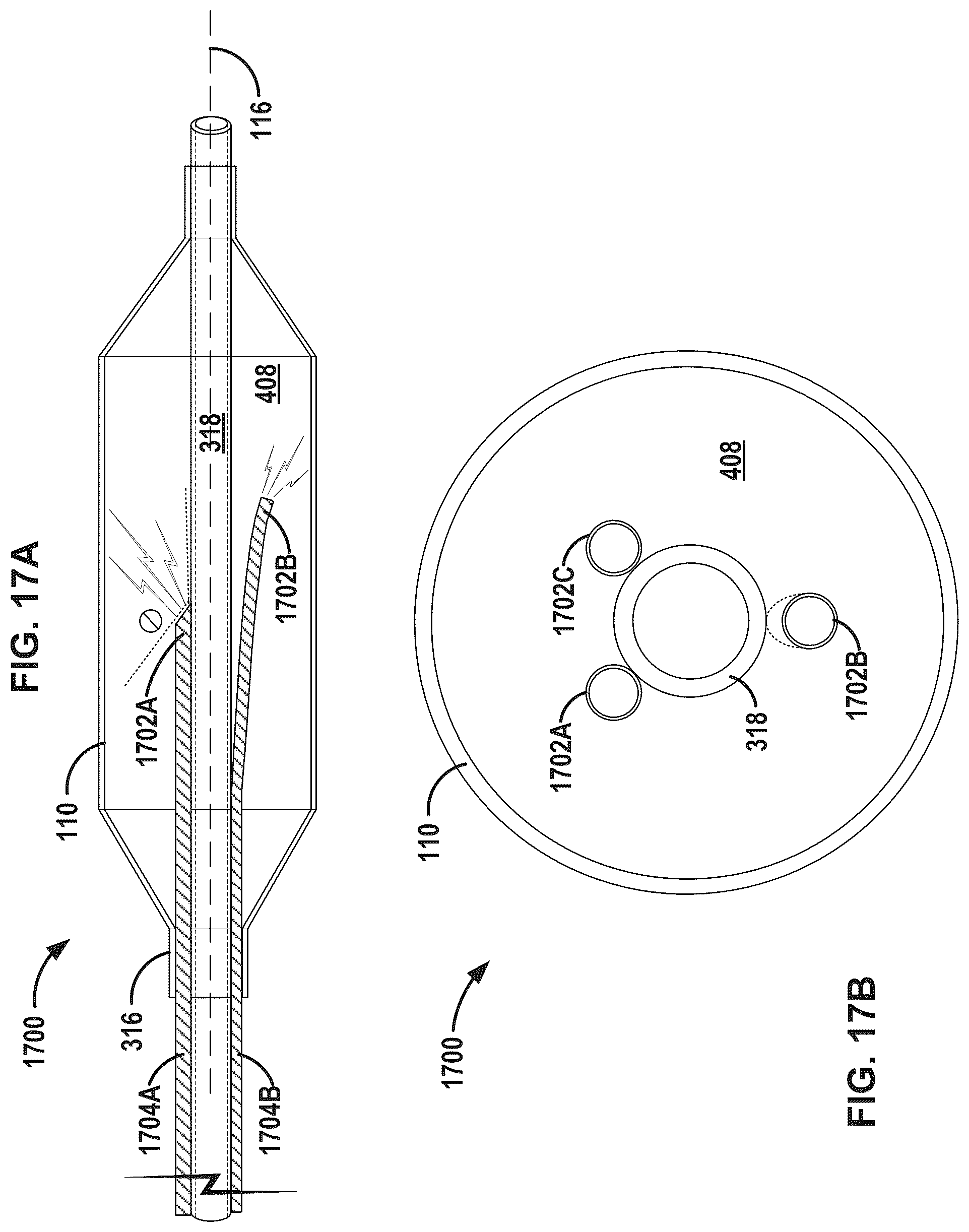 Patent US12376869 Figure 20 – Intravascular lithotripsy