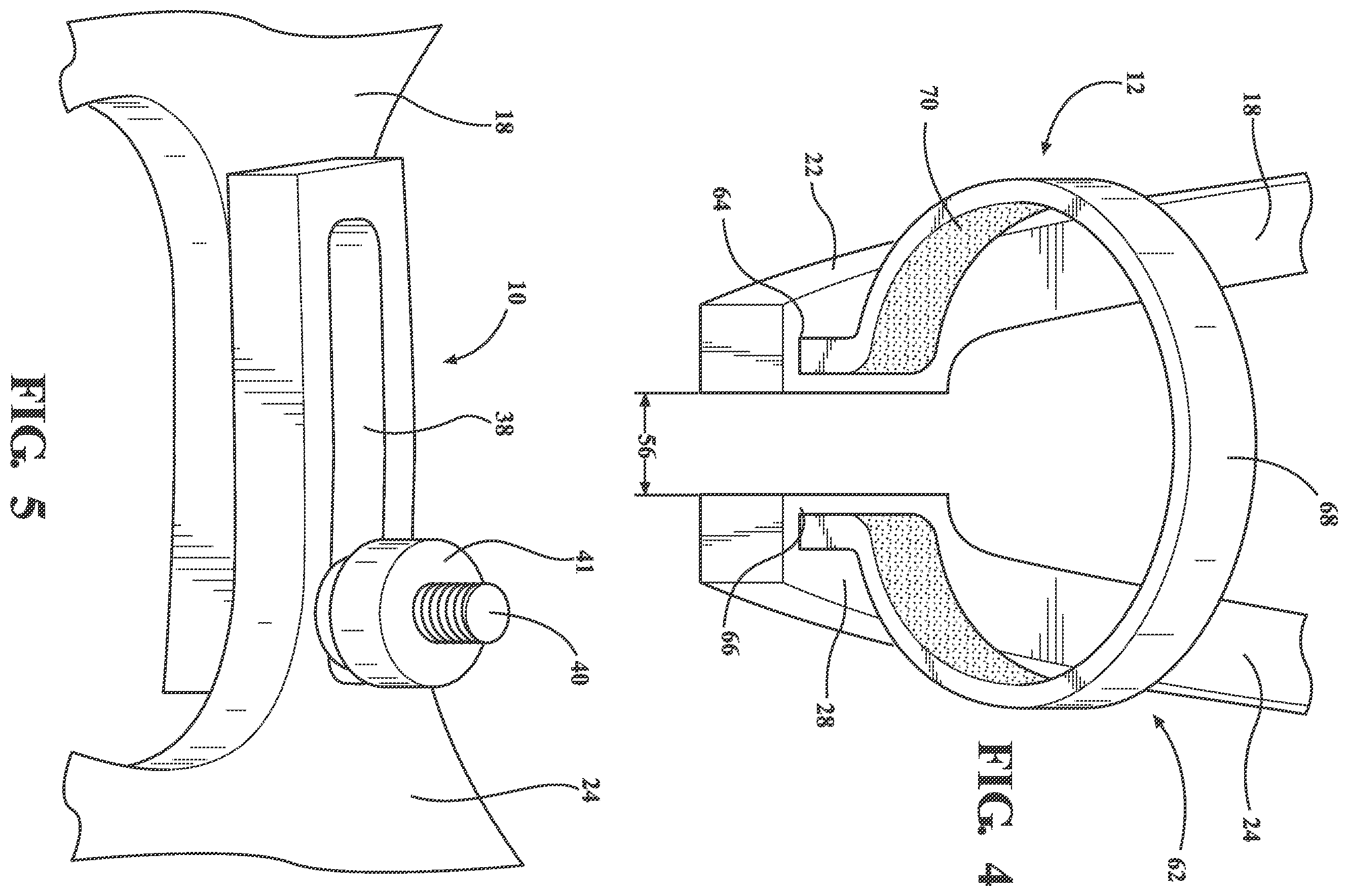 Patent US12376871 Figure 4 – Atraumatic tenaculum for facilitation of transcervical procedures