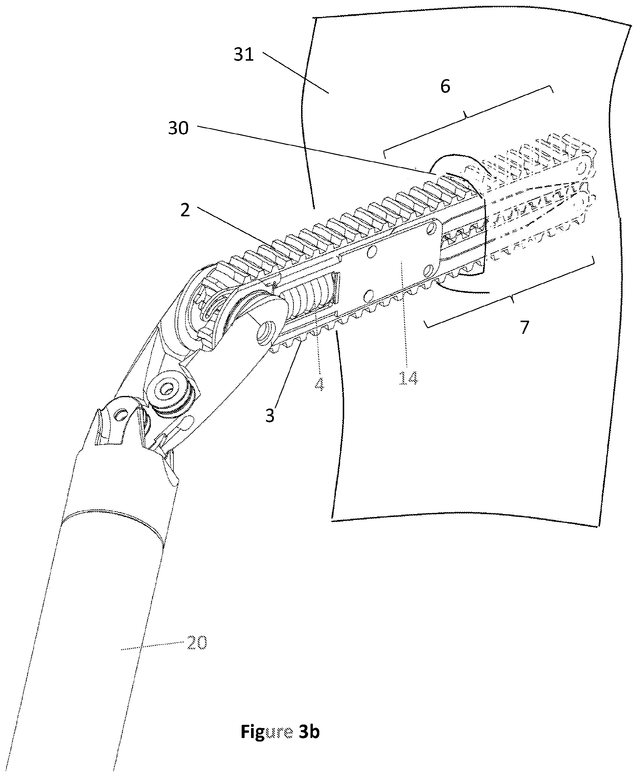 Patent US12376873 Figure 6 – Surgical instrument for blunt dissection, dilation of incisions, and separation of adhesions