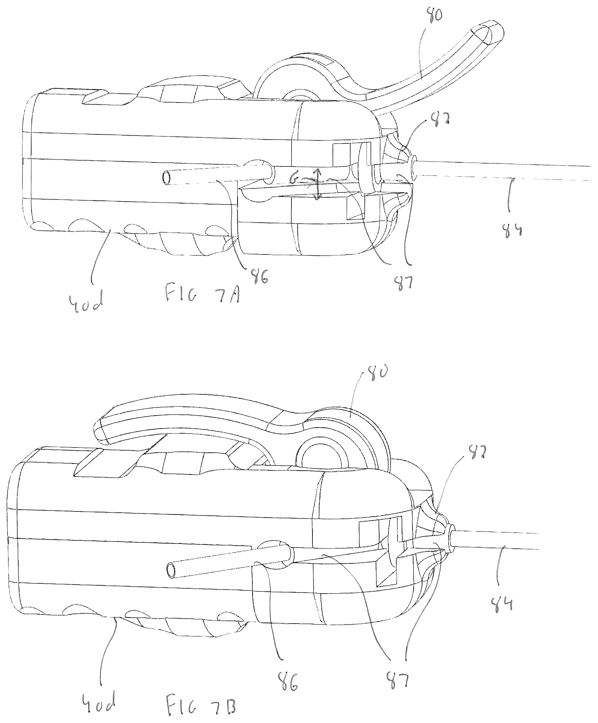 Patent US12376874 Figure 5 – Vibrating surgical instrument for liposuction and other body contouring applications