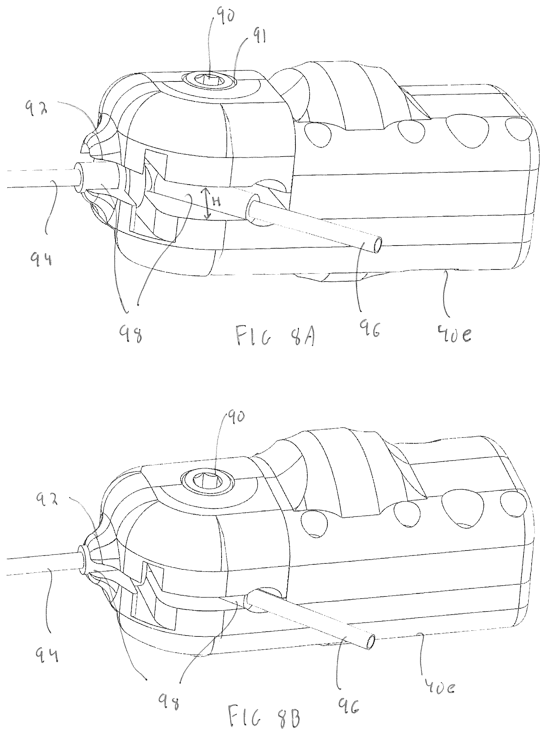 Patent US12376874 Figure 6 – Vibrating surgical instrument for liposuction and other body contouring applications