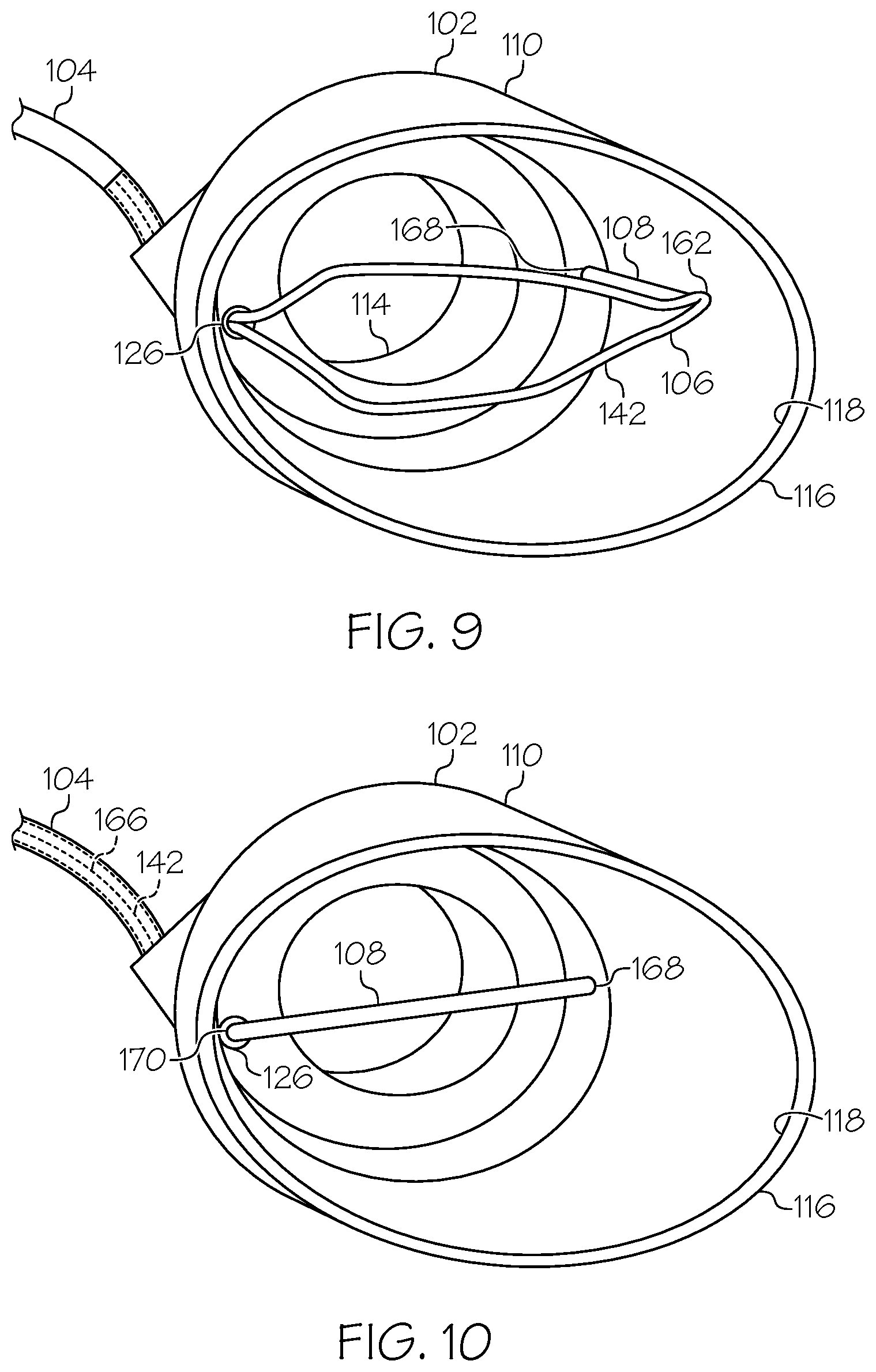 Patent US12376875 Figure 5 – Endoscopic tissue resection device