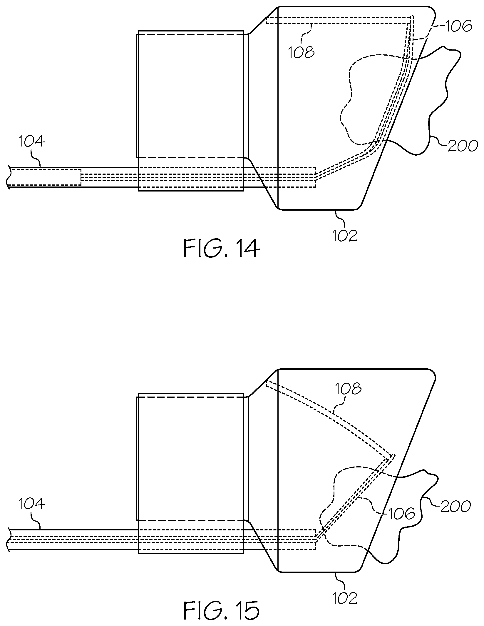 Patent US12376875 Figure 8 – Endoscopic tissue resection device