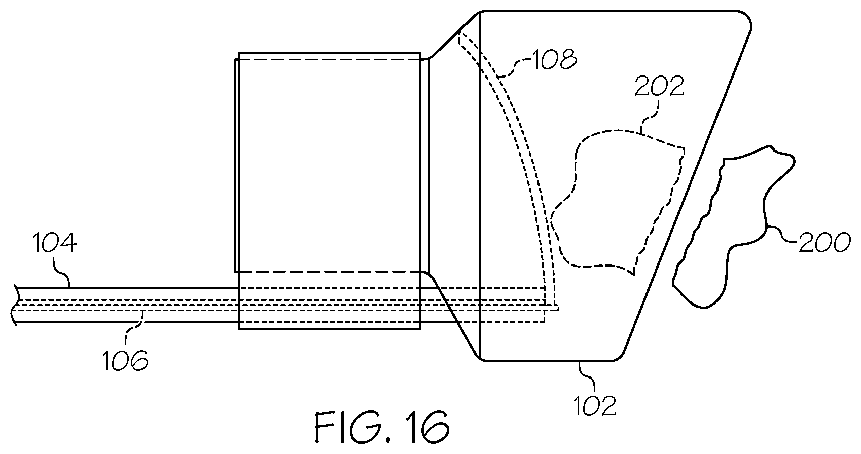Patent US12376875 Figure 9 – Endoscopic tissue resection device