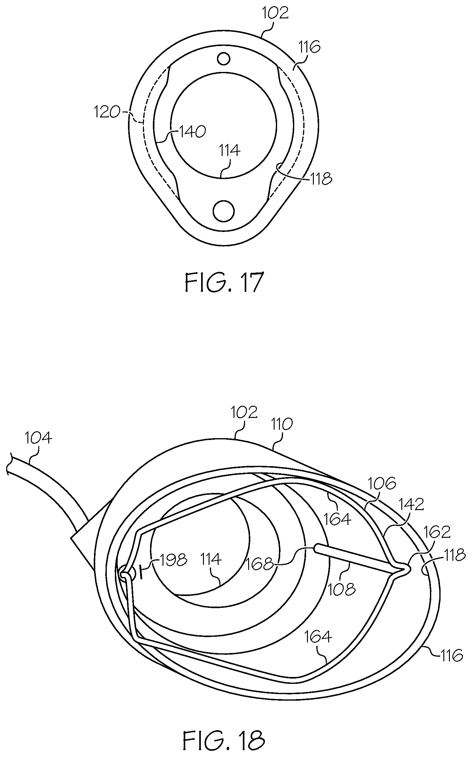 Patent US12376875 Figure 10 – Endoscopic tissue resection device