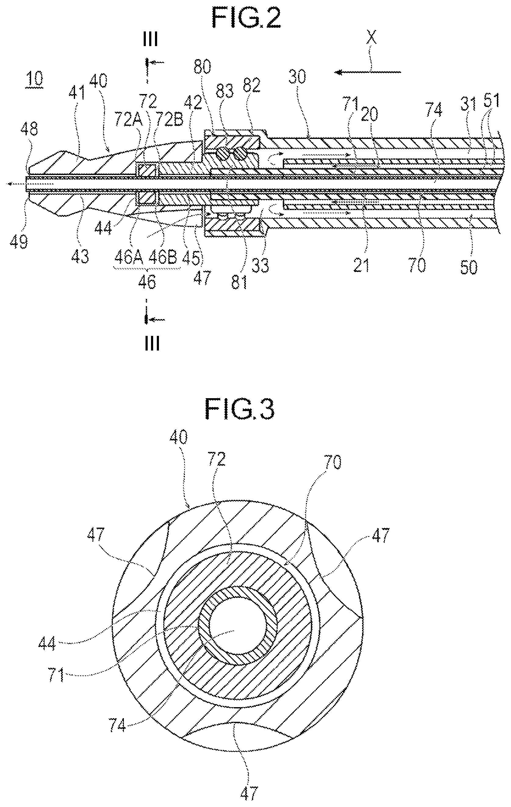 Patent US12376878 Figure 2 – Medical device