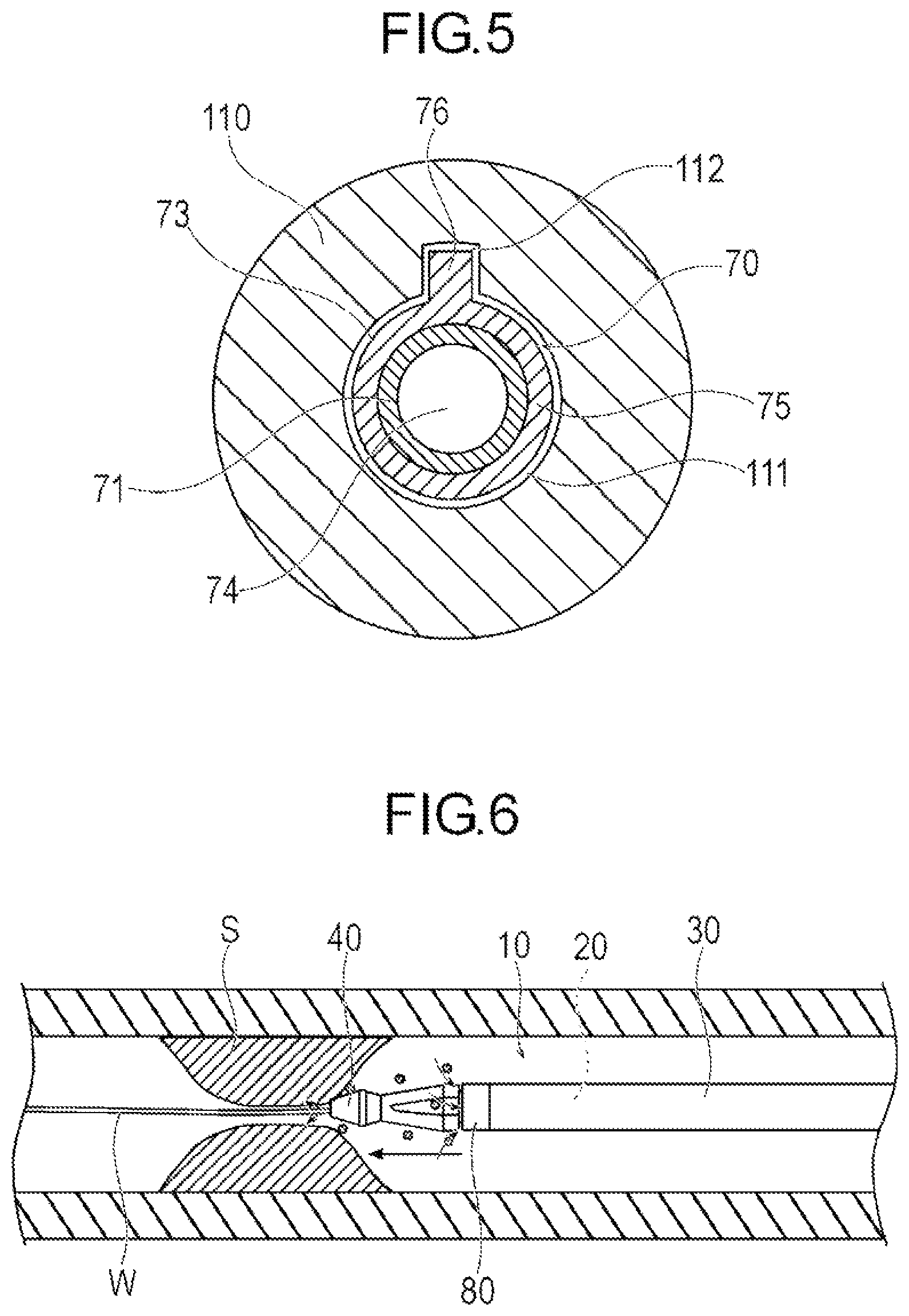 Patent US12376878 Figure 4 – Medical device