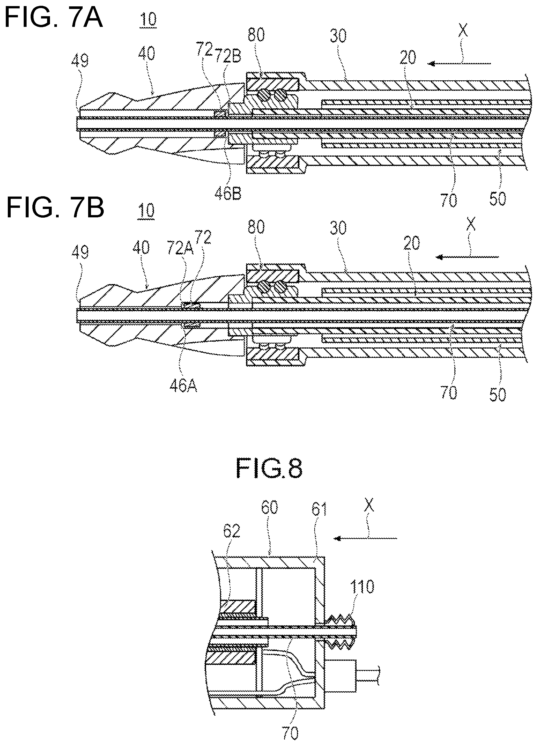 Patent US12376878 Figure 5 – Medical device