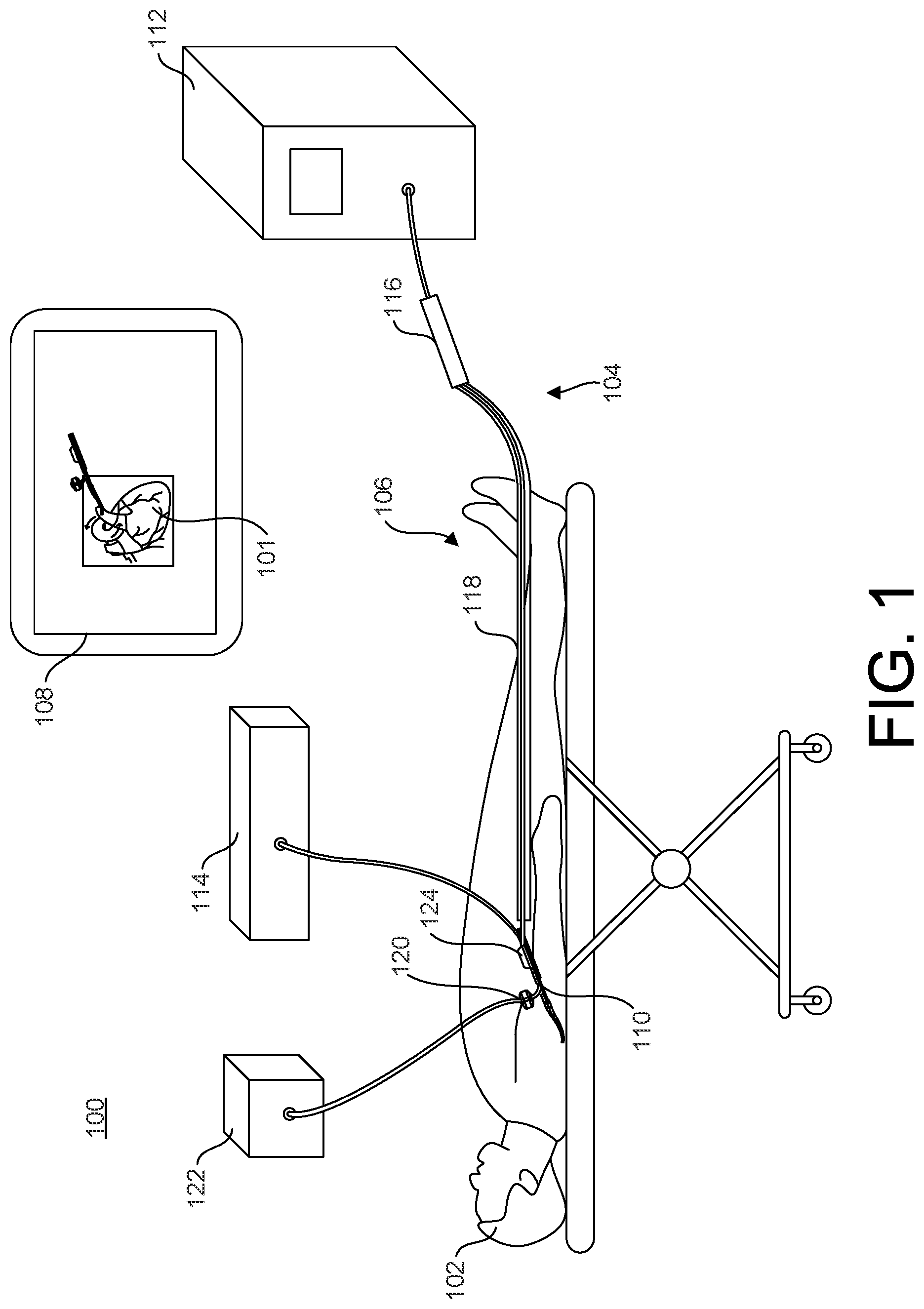 Patent US12376879 Figure 1 – Expandable elements for shunting catheters