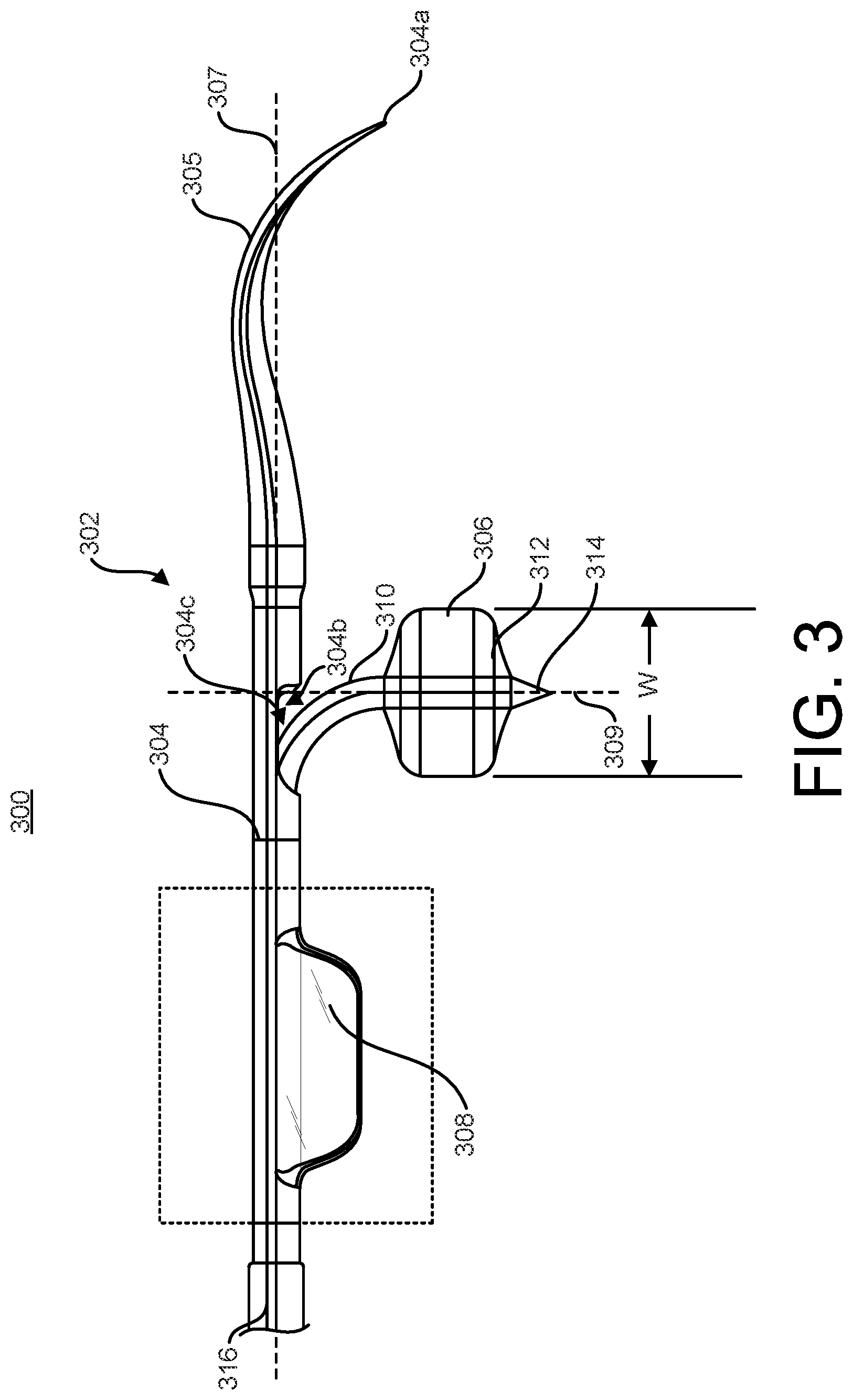 Patent US12376879 Figure 3 – Expandable elements for shunting catheters