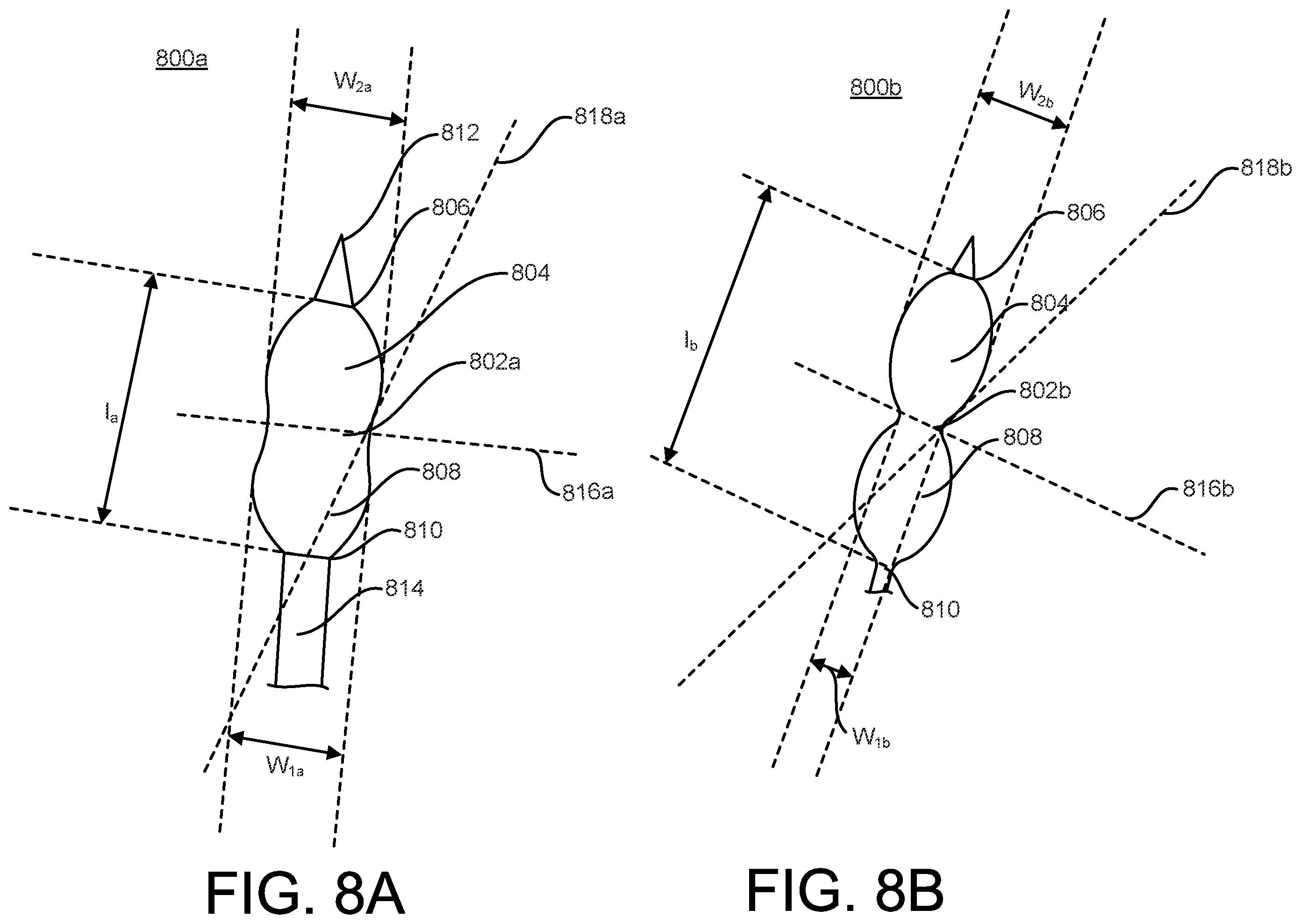 Patent US12376879 Figure 12 – Expandable elements for shunting catheters