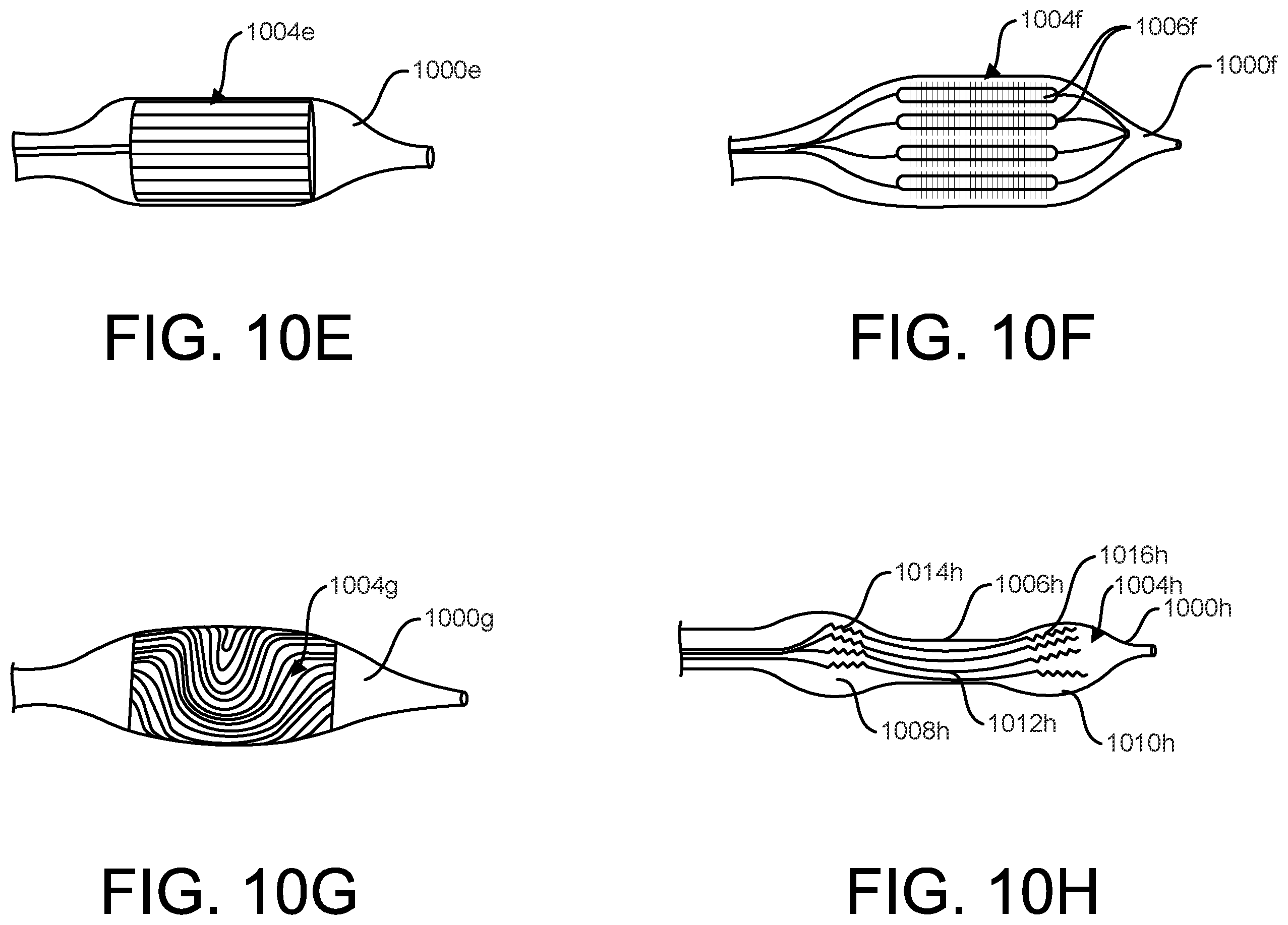 Patent US12376879 Figure 16 – Expandable elements for shunting catheters