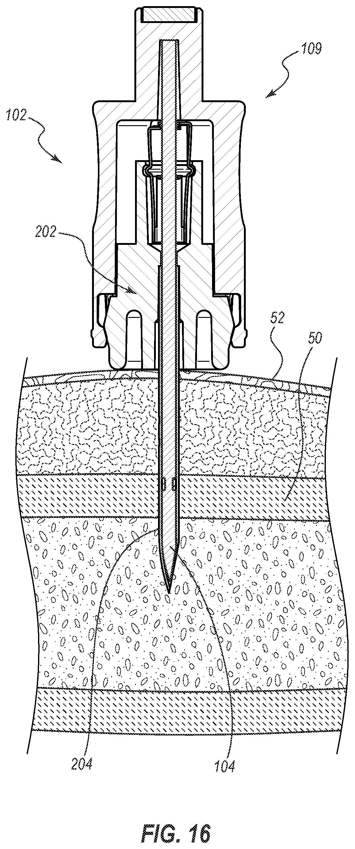 Patent US12376881 Figure 14 – Safety shields for elongated instruments and related systems and methods