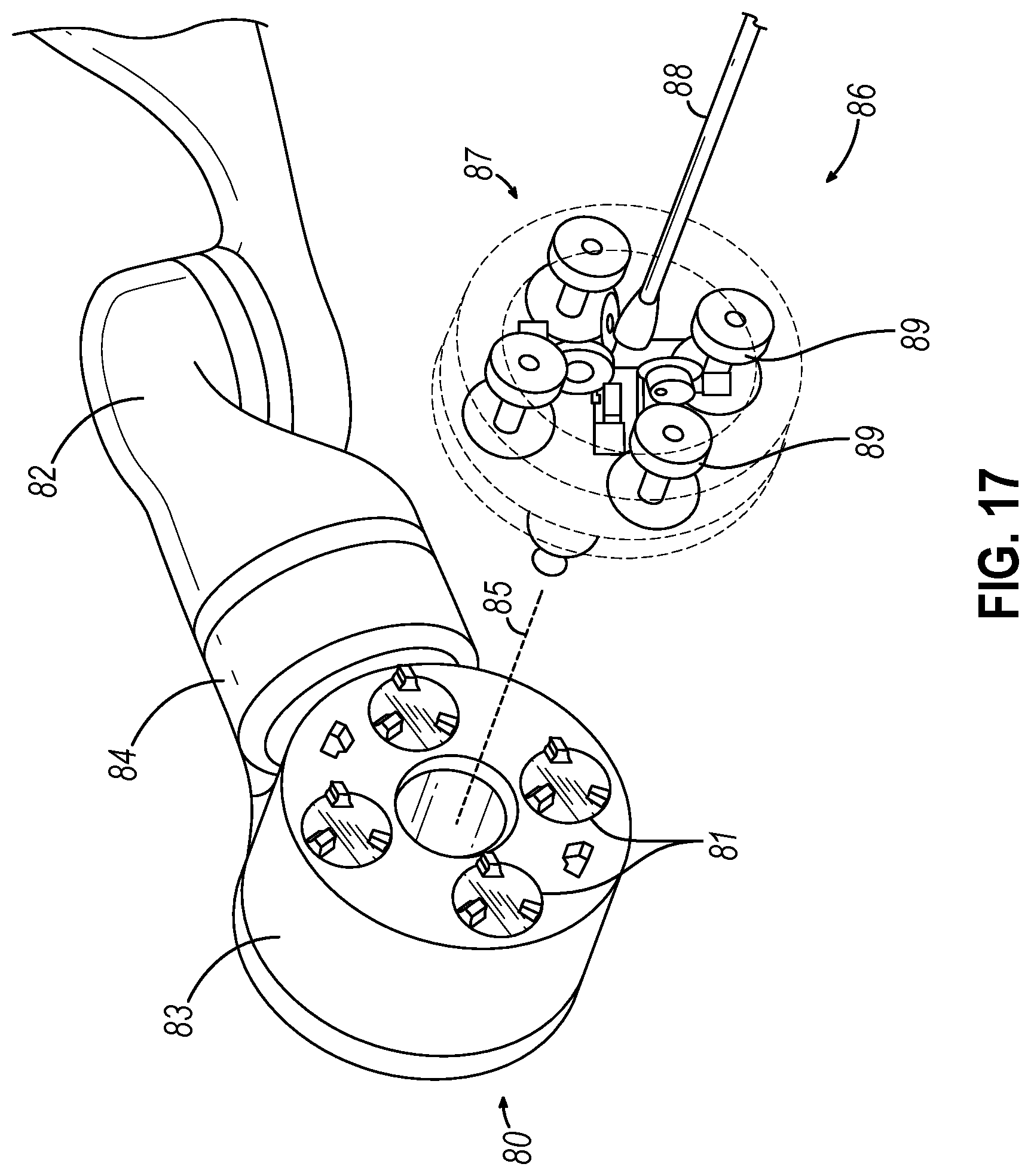 Patent US12376883 Figure 16 – Uterine manipulator control with presentation of critical structures