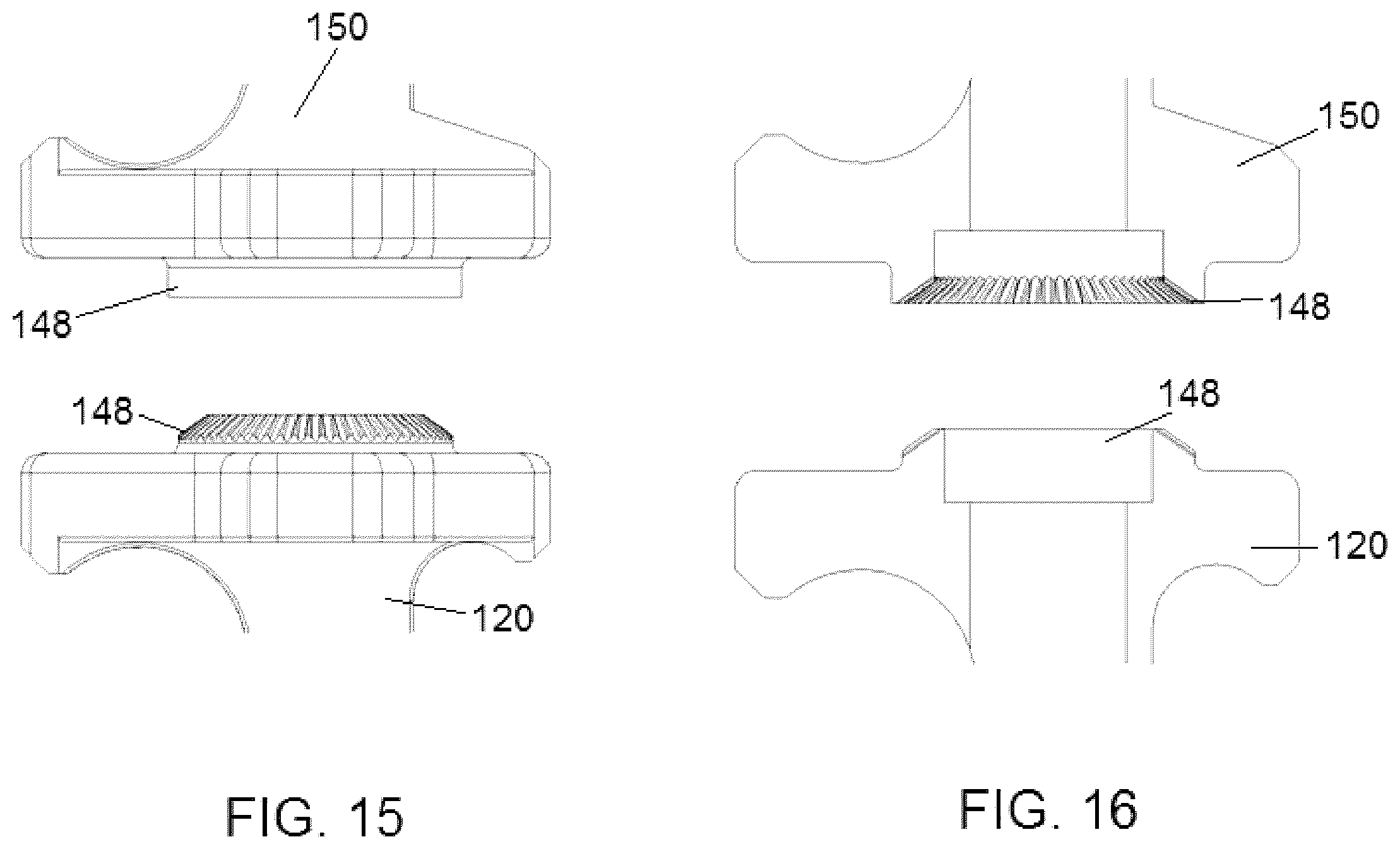Patent US12376885 Figure 17 – External fixator assembly