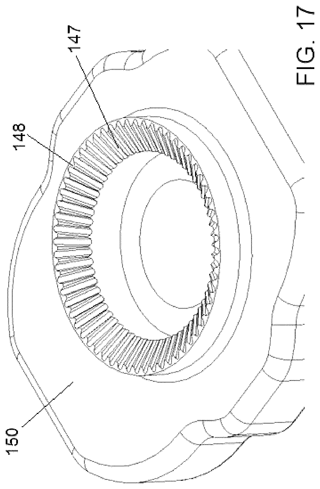 Patent US12376885 Figure 18 – External fixator assembly