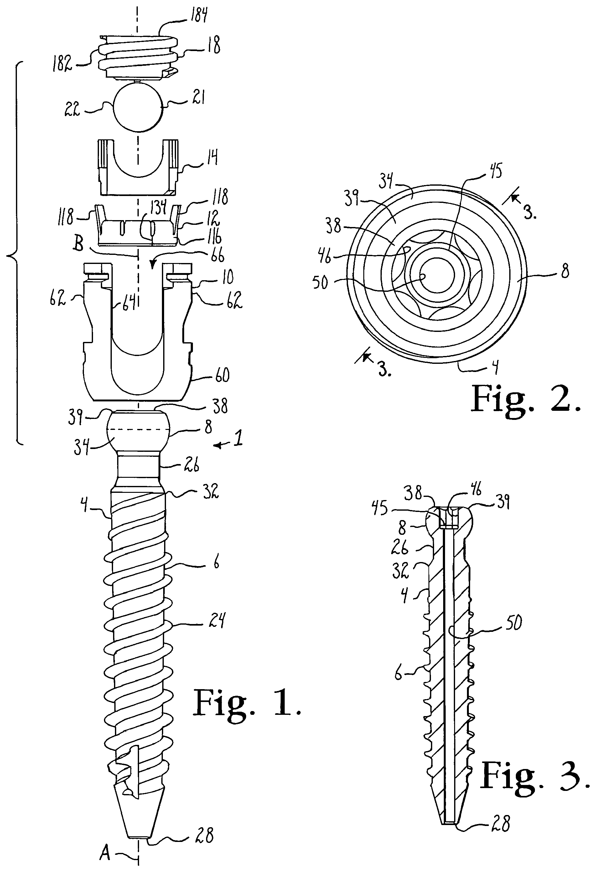 Patent US12376886 Figure 1 – Pivotal bone anchor assembly with retainer pre-positioned in expansion chamber and tool-deployable insert