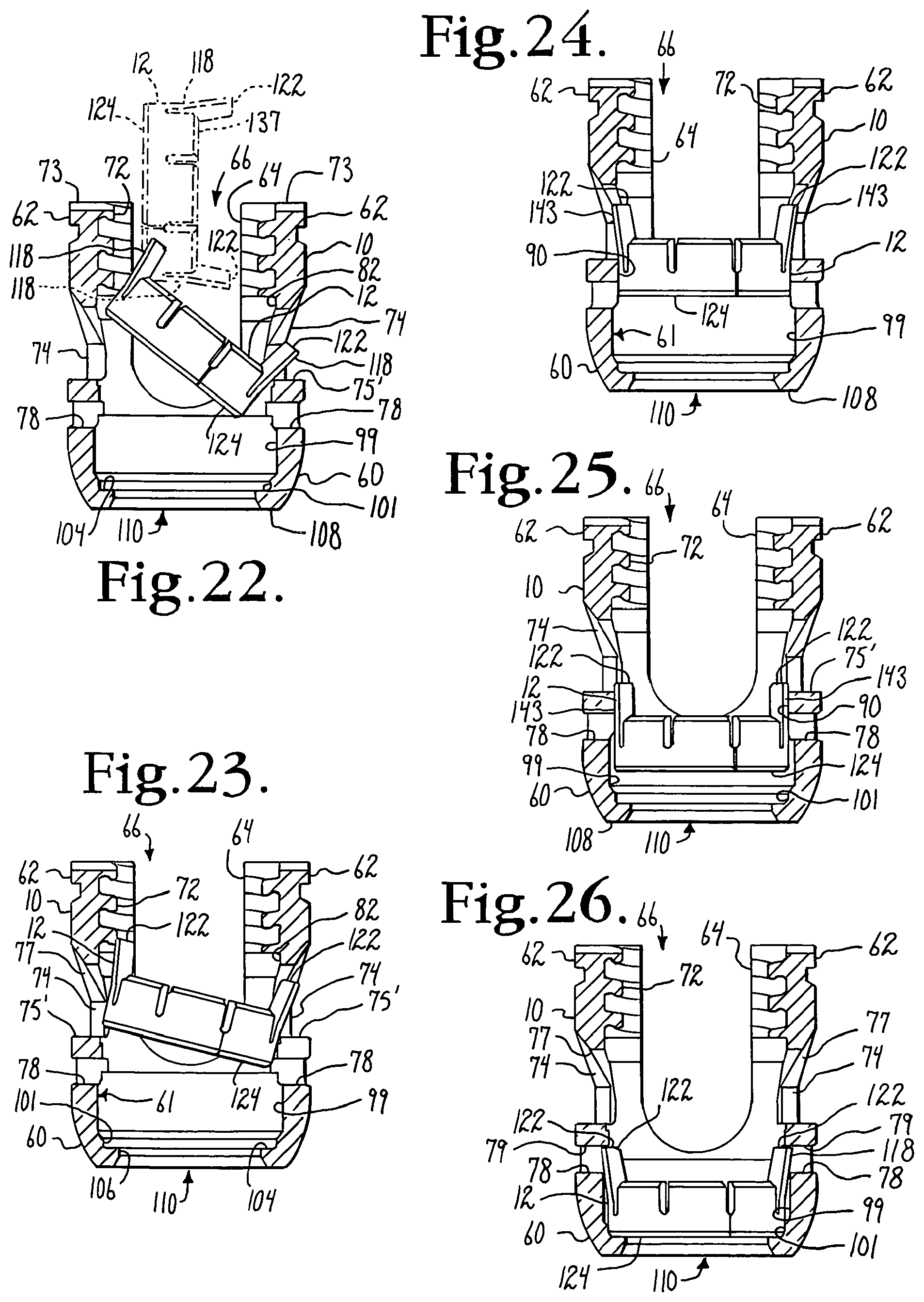 Patent US12376886 Figure 6 – Pivotal bone anchor assembly with retainer pre-positioned in expansion chamber and tool-deployable insert