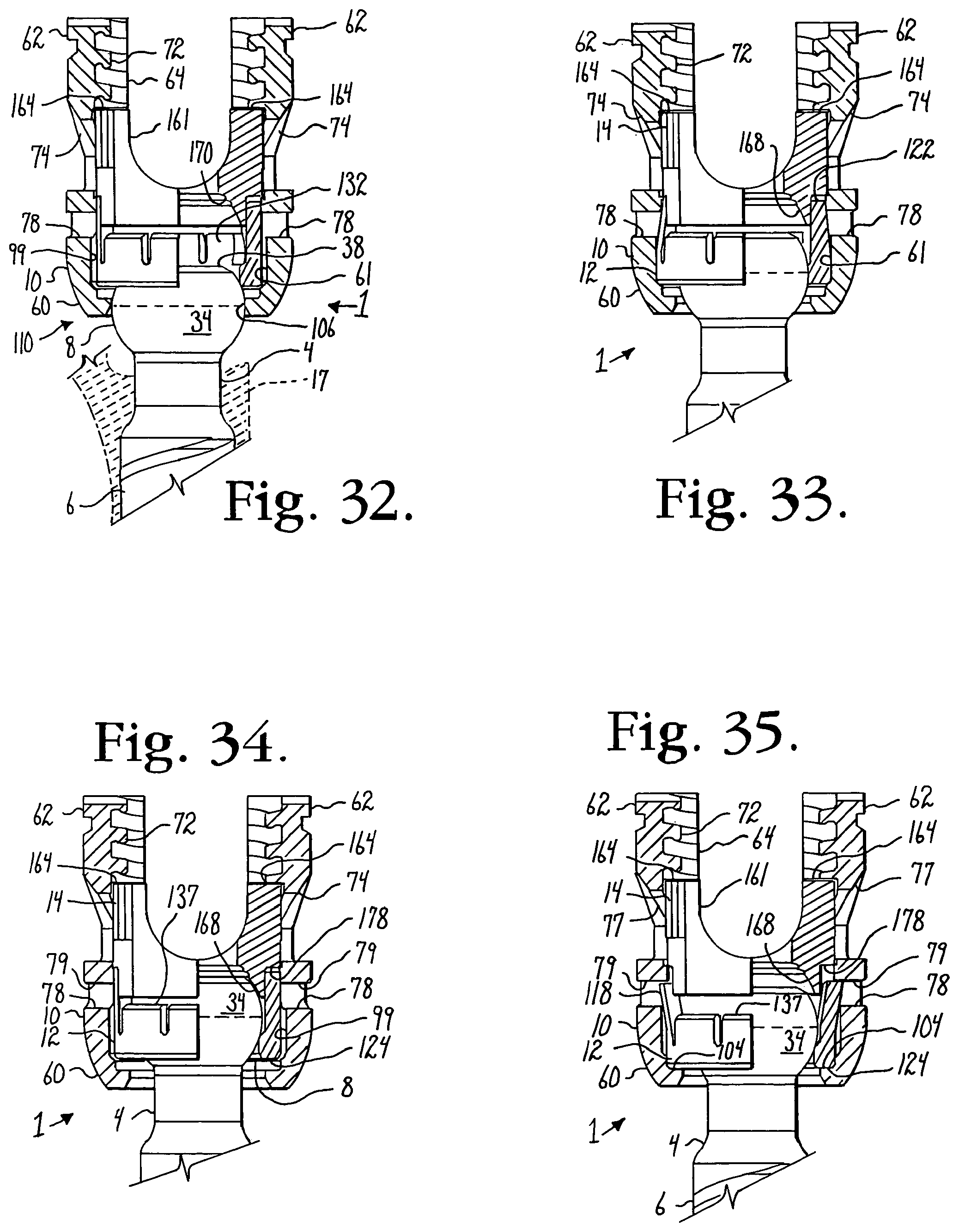 Patent US12376886 Figure 8 – Pivotal bone anchor assembly with retainer pre-positioned in expansion chamber and tool-deployable insert