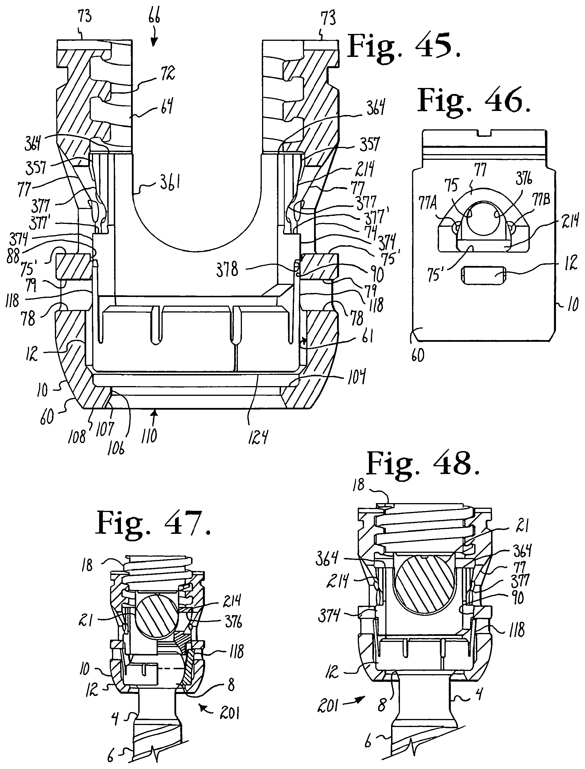 Patent US12376886 Figure 11 – Pivotal bone anchor assembly with retainer pre-positioned in expansion chamber and tool-deployable insert