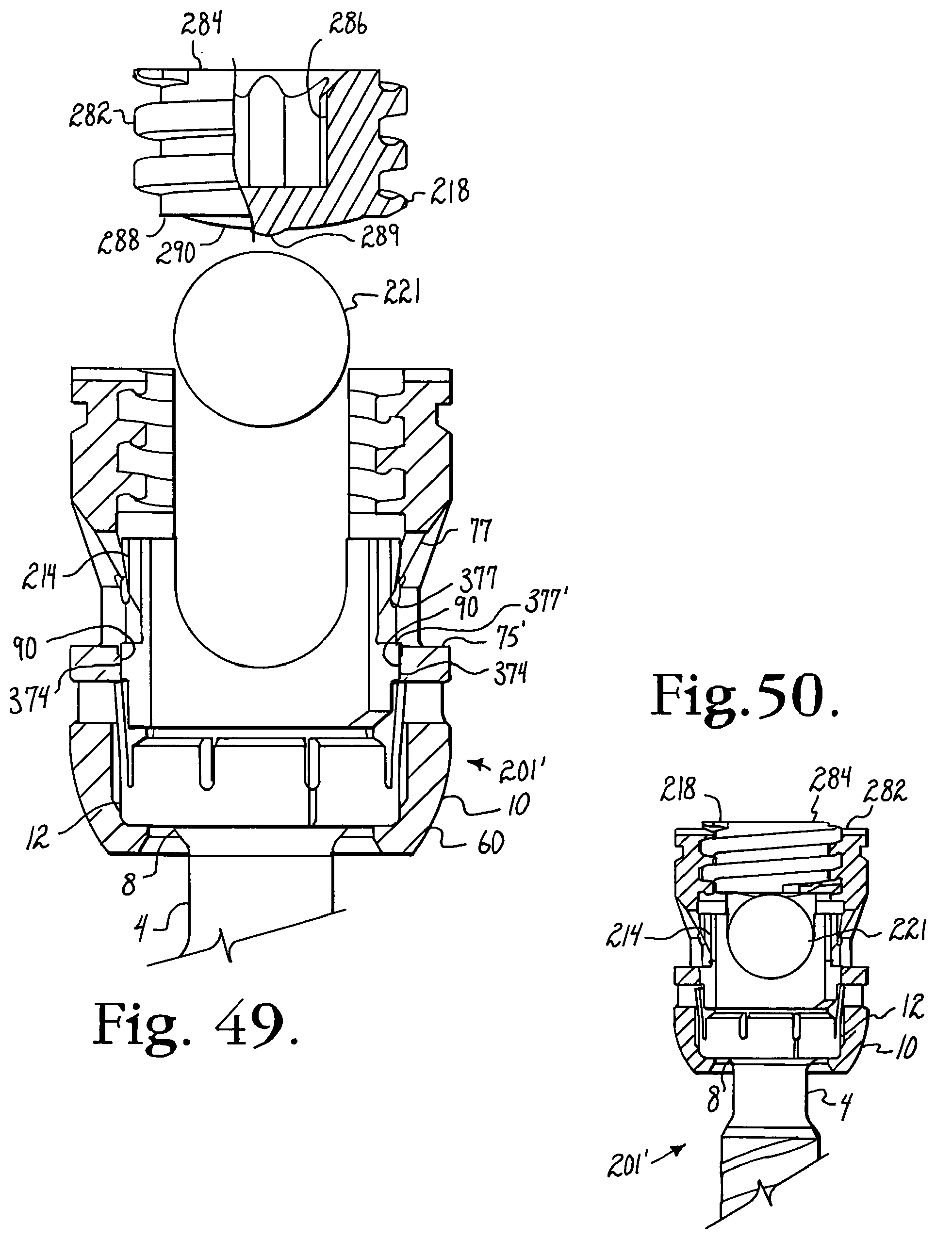 Patent US12376886 Figure 12 – Pivotal bone anchor assembly with retainer pre-positioned in expansion chamber and tool-deployable insert