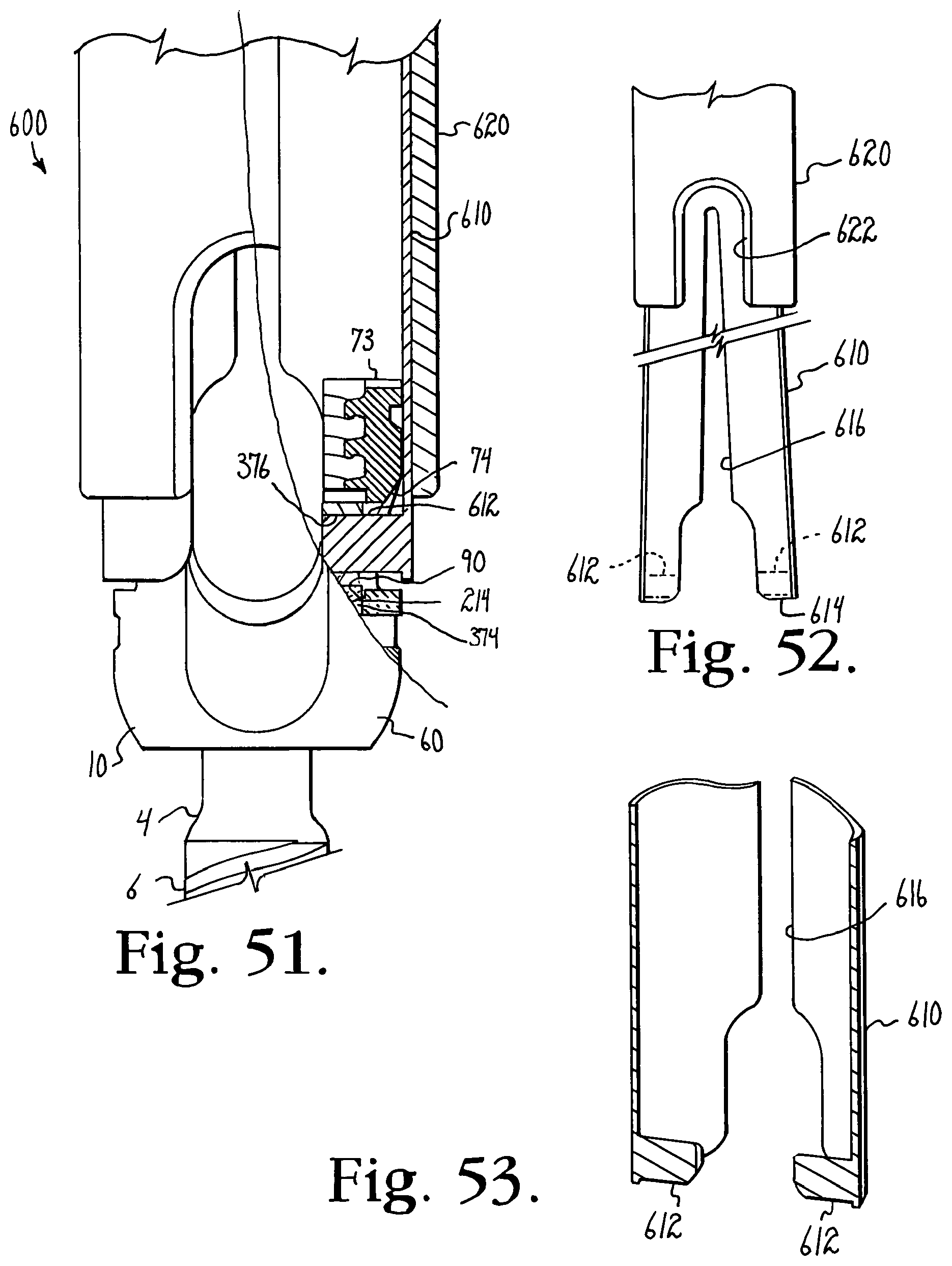 Patent US12376886 Figure 13 – Pivotal bone anchor assembly with retainer pre-positioned in expansion chamber and tool-deployable insert