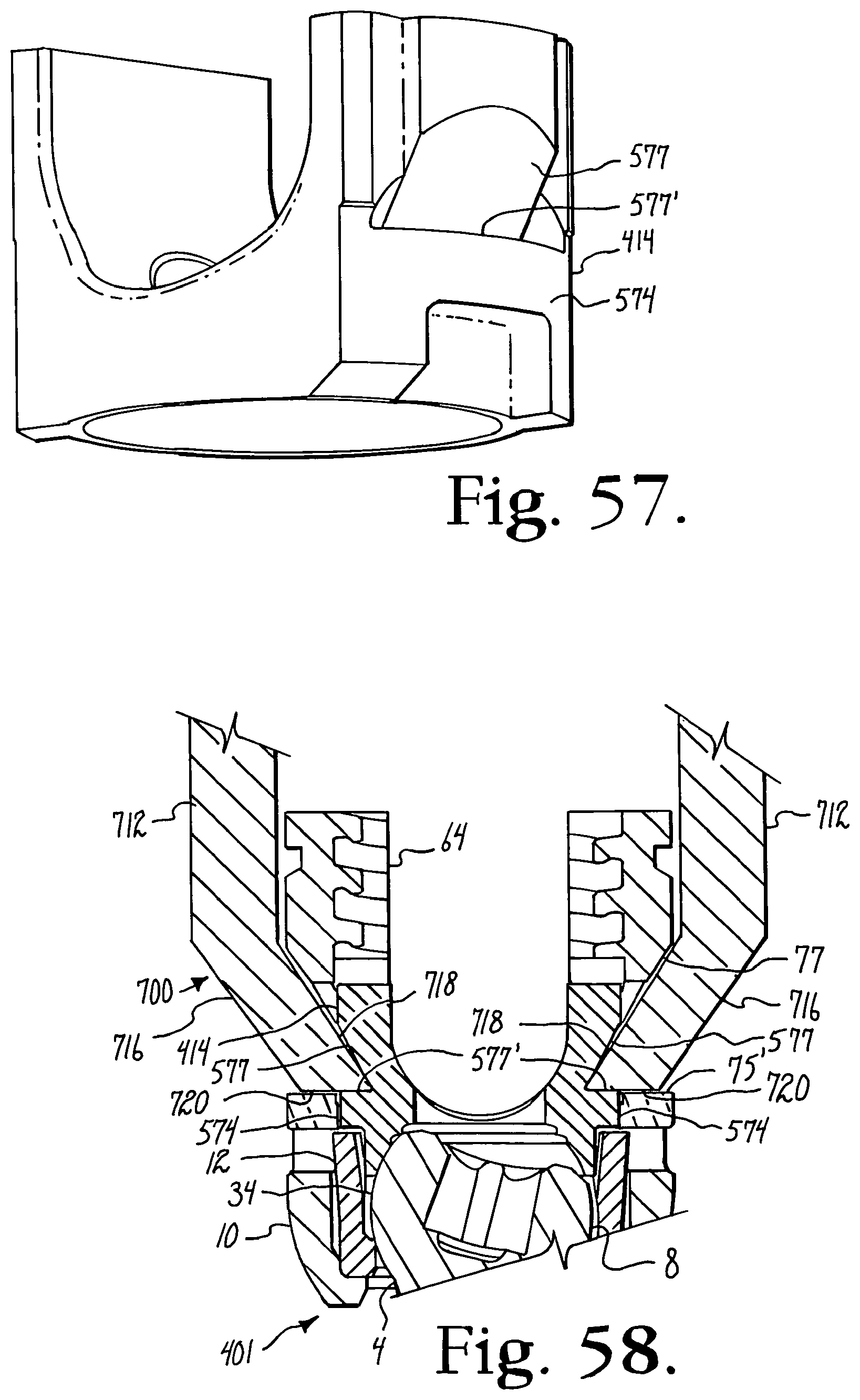 Patent US12376886 Figure 15 – Pivotal bone anchor assembly with retainer pre-positioned in expansion chamber and tool-deployable insert