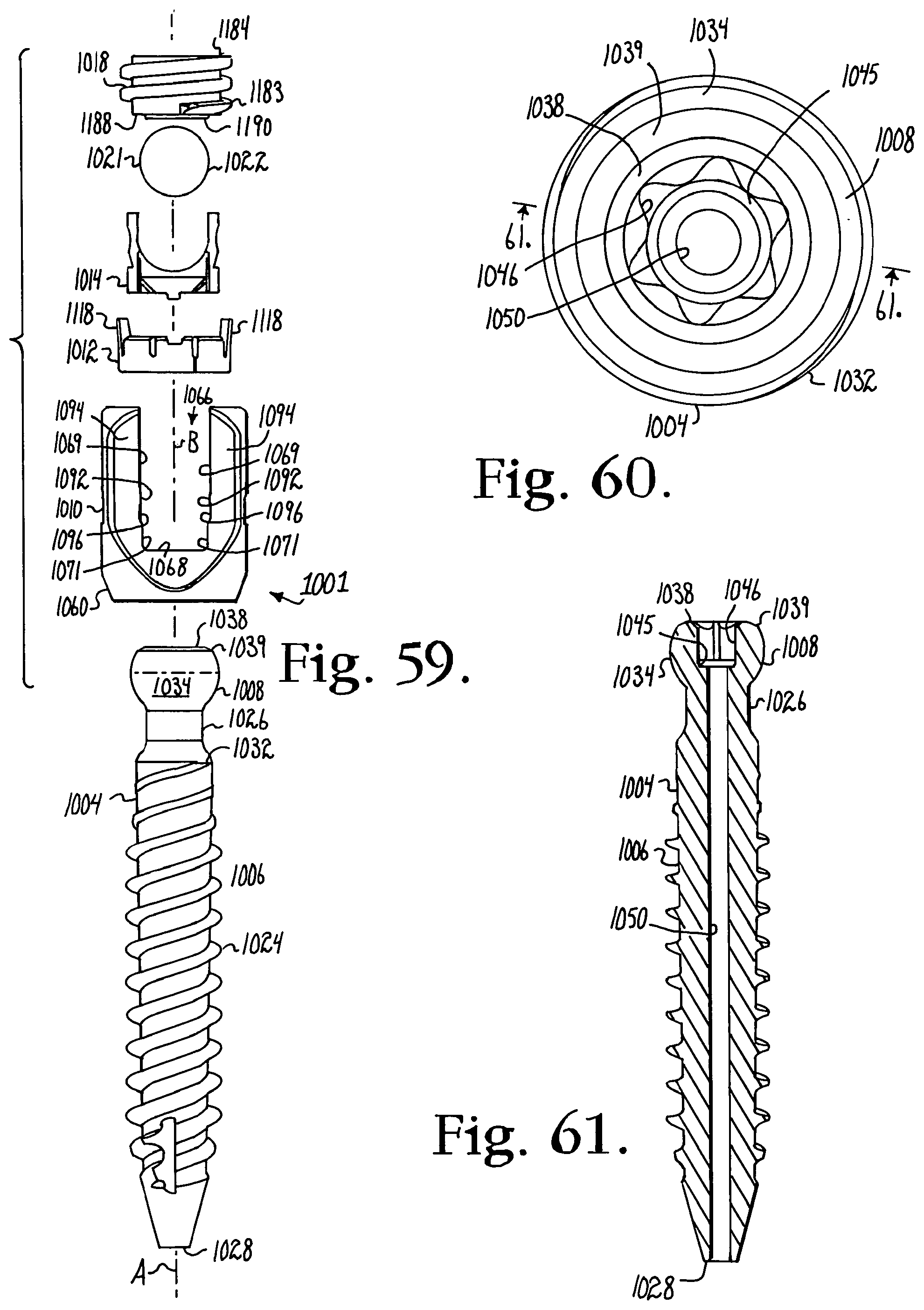 Patent US12376886 Figure 16 – Pivotal bone anchor assembly with retainer pre-positioned in expansion chamber and tool-deployable insert