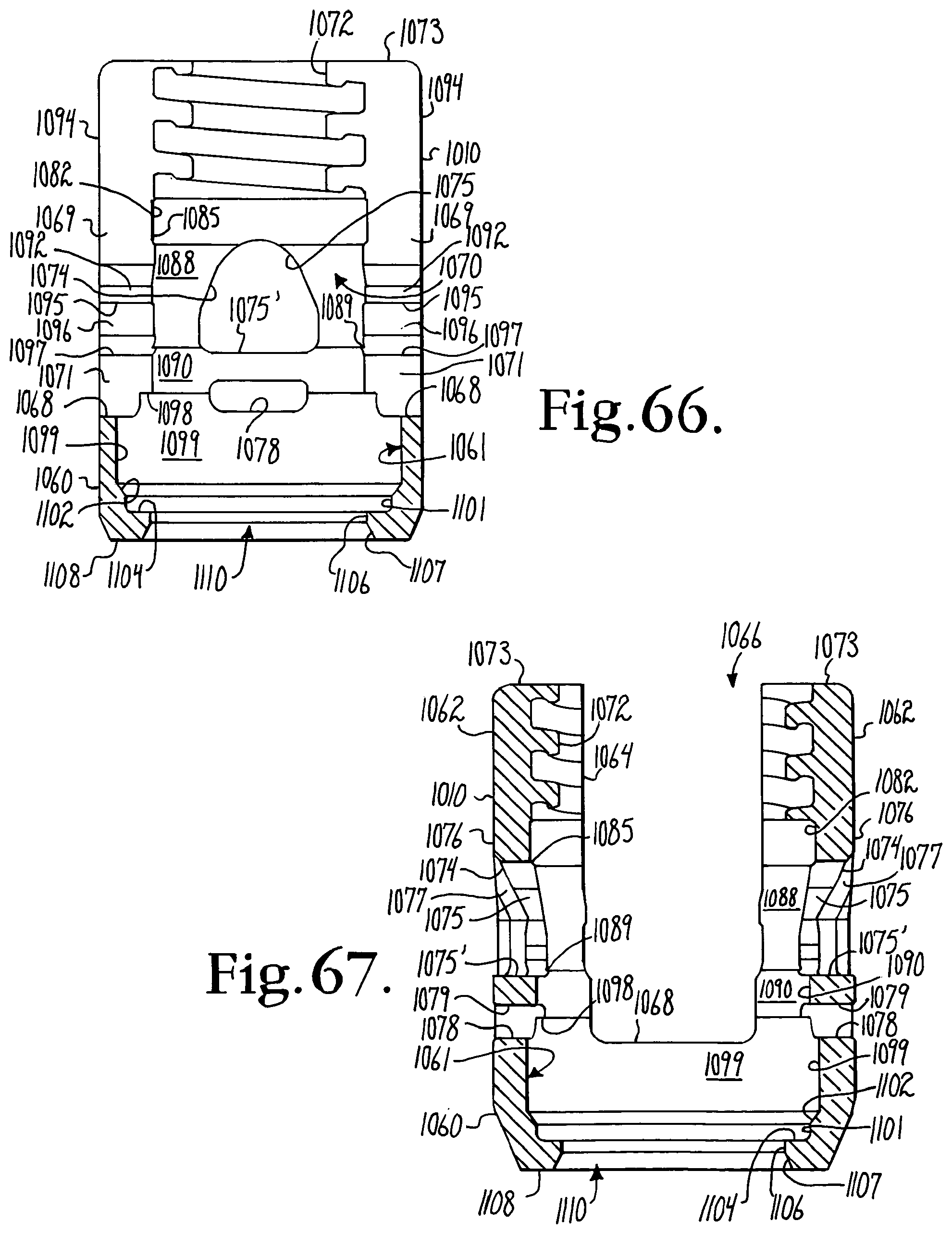 Patent US12376886 Figure 18 – Pivotal bone anchor assembly with retainer pre-positioned in expansion chamber and tool-deployable insert