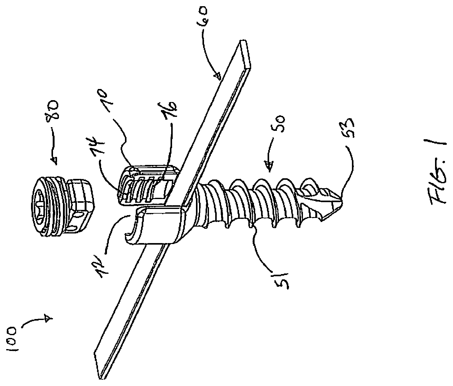 Patent US12376887 Figure 1 – Tethering screw system