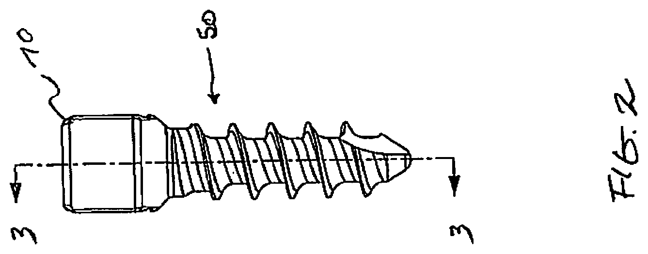 Patent US12376887 Figure 2 – Tethering screw system
