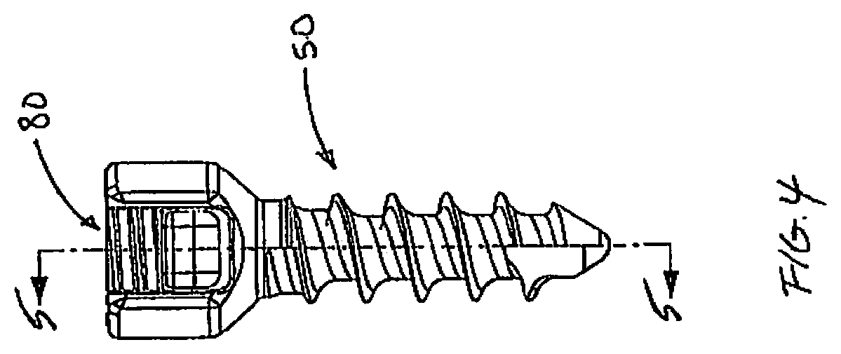 Patent US12376887 Figure 4 – Tethering screw system