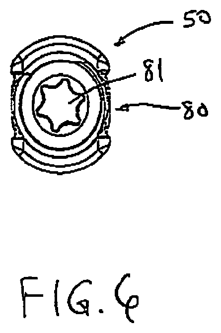 Patent US12376887 Figure 6 – Tethering screw system