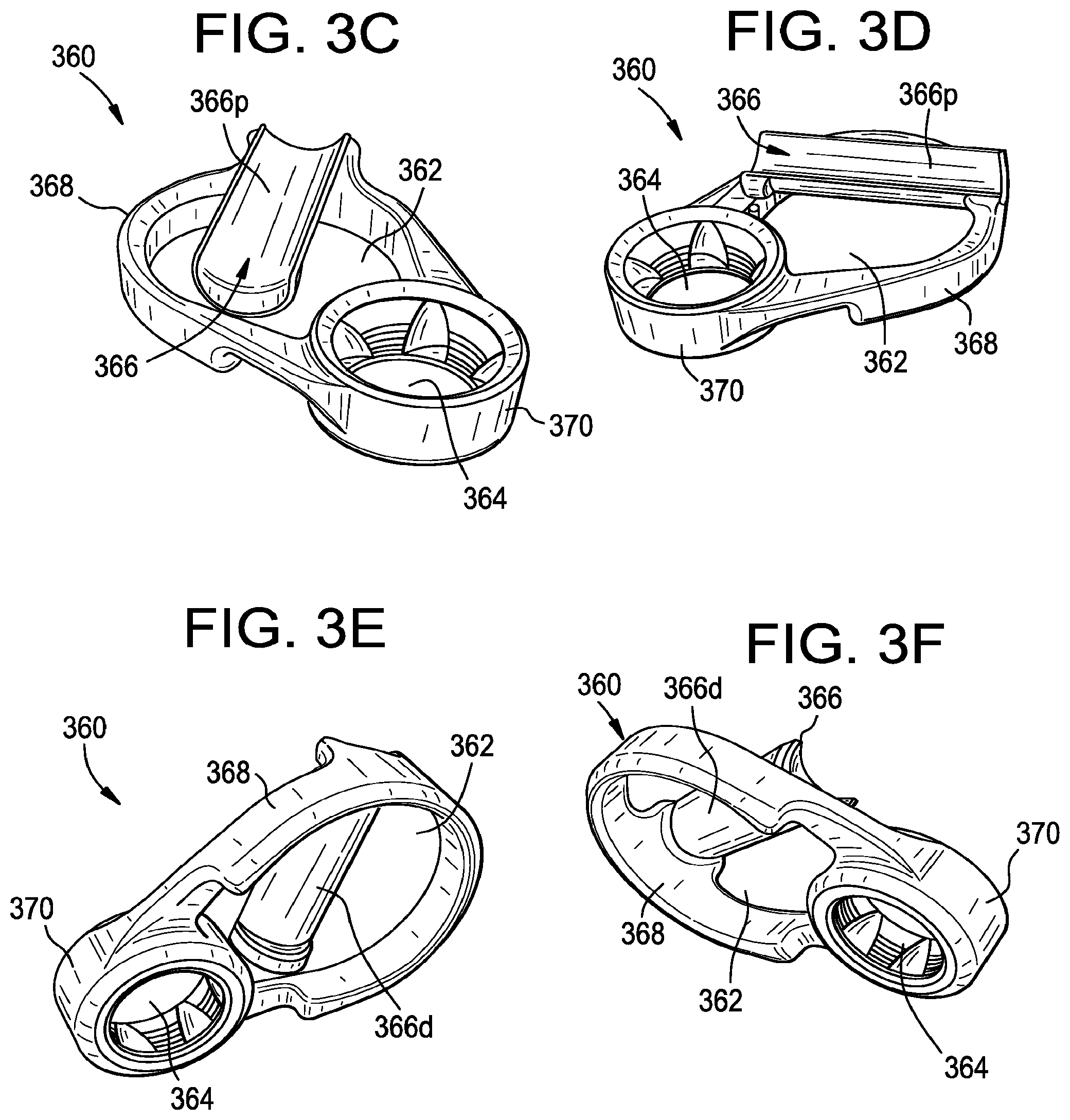 Patent US12376888 Figure 8 – Multipoint fixation implants