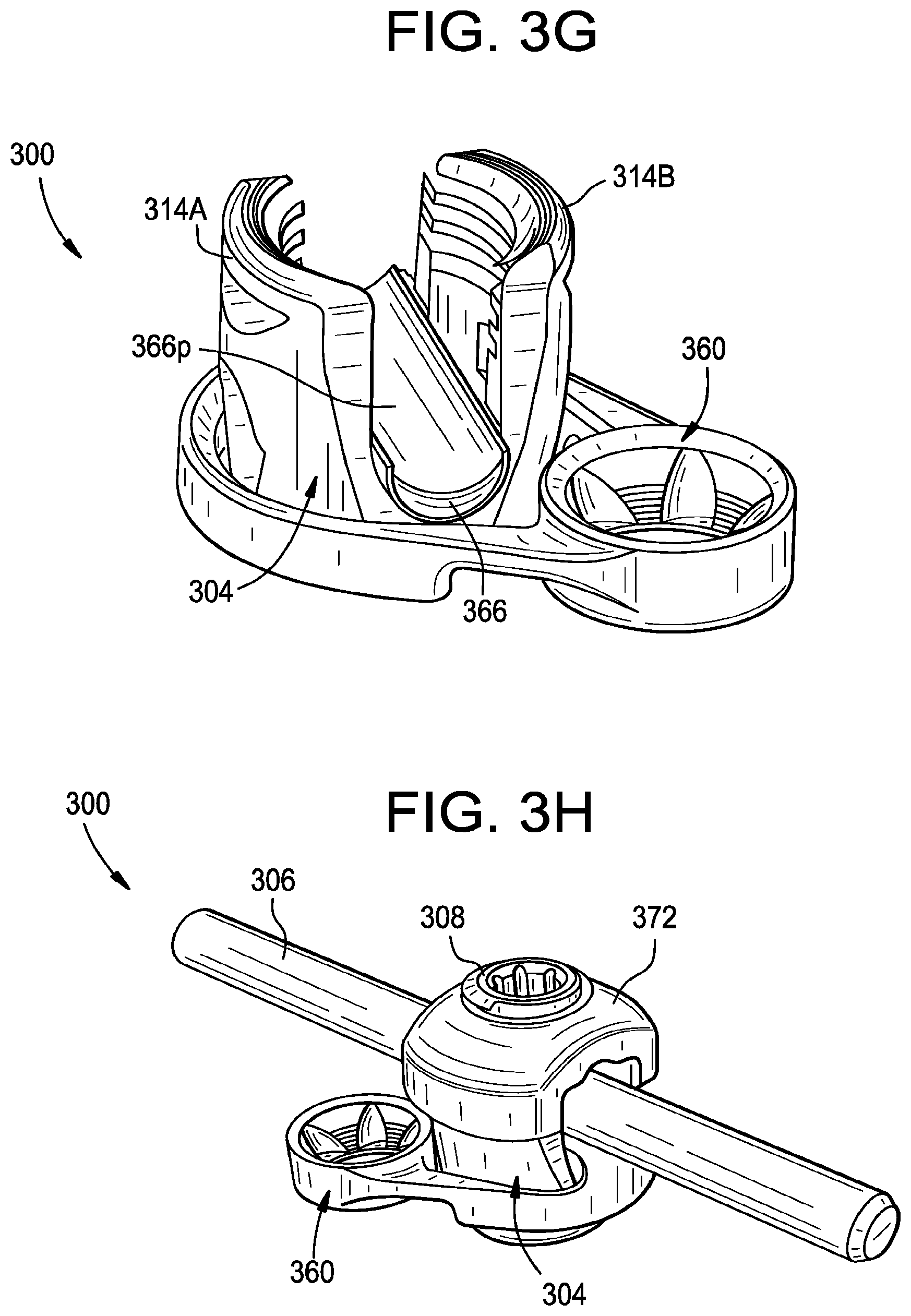 Patent US12376888 Figure 9 – Multipoint fixation implants