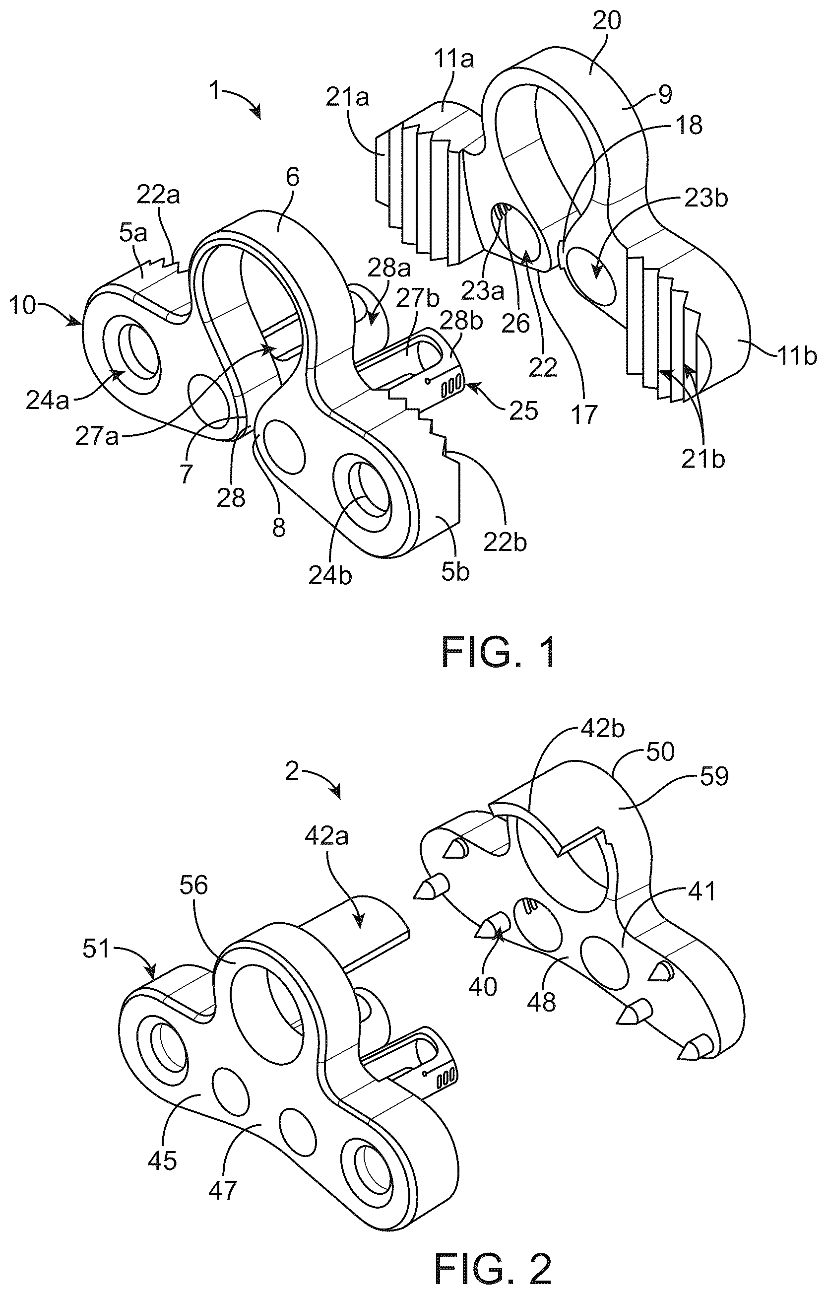 Patent US12376890 Figure 1 – Dynamic and non-dynamic interspinous fusion implant and bone growth stimulation system