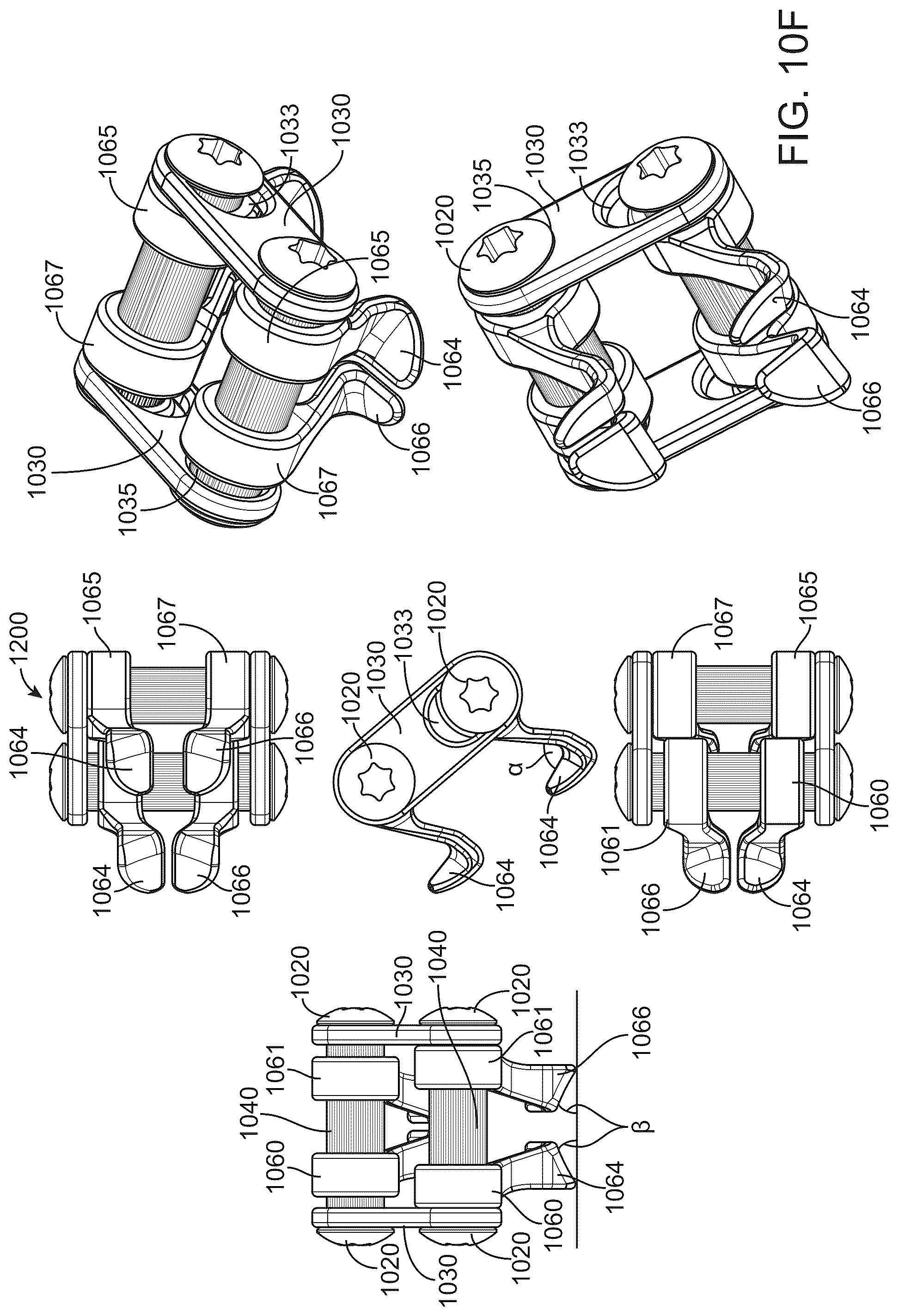 Patent US12376890 Figure 12 – Dynamic and non-dynamic interspinous fusion implant and bone growth stimulation system