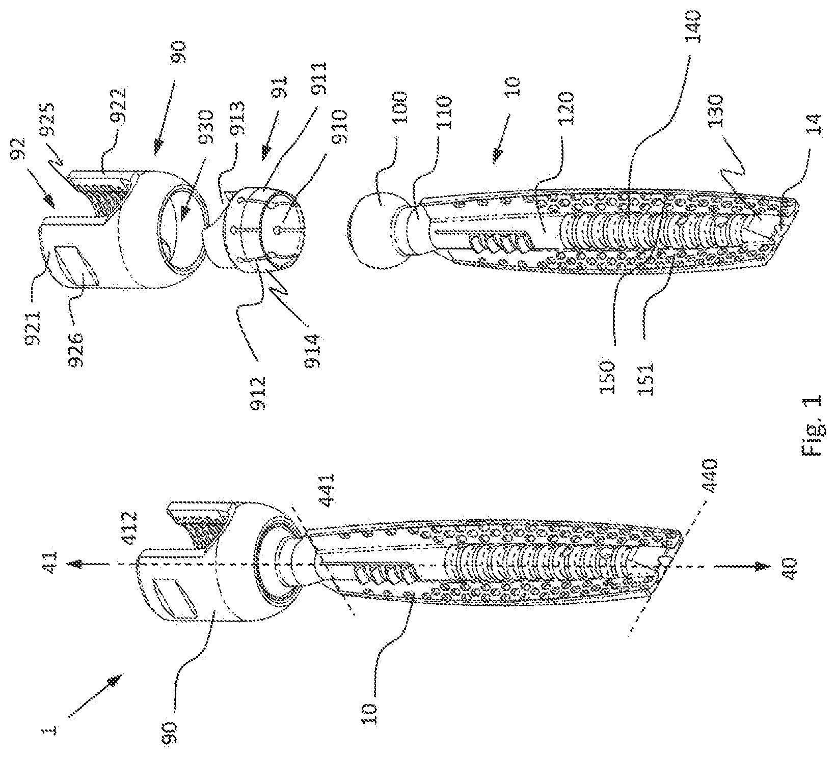 Patent US12376892 Figure 1 – Bone-anchoring device for a pedicle access