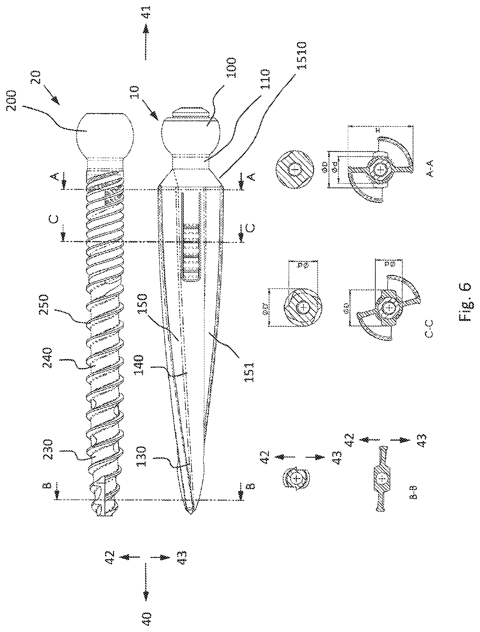 Patent US12376892 Figure 6 – Bone-anchoring device for a pedicle access